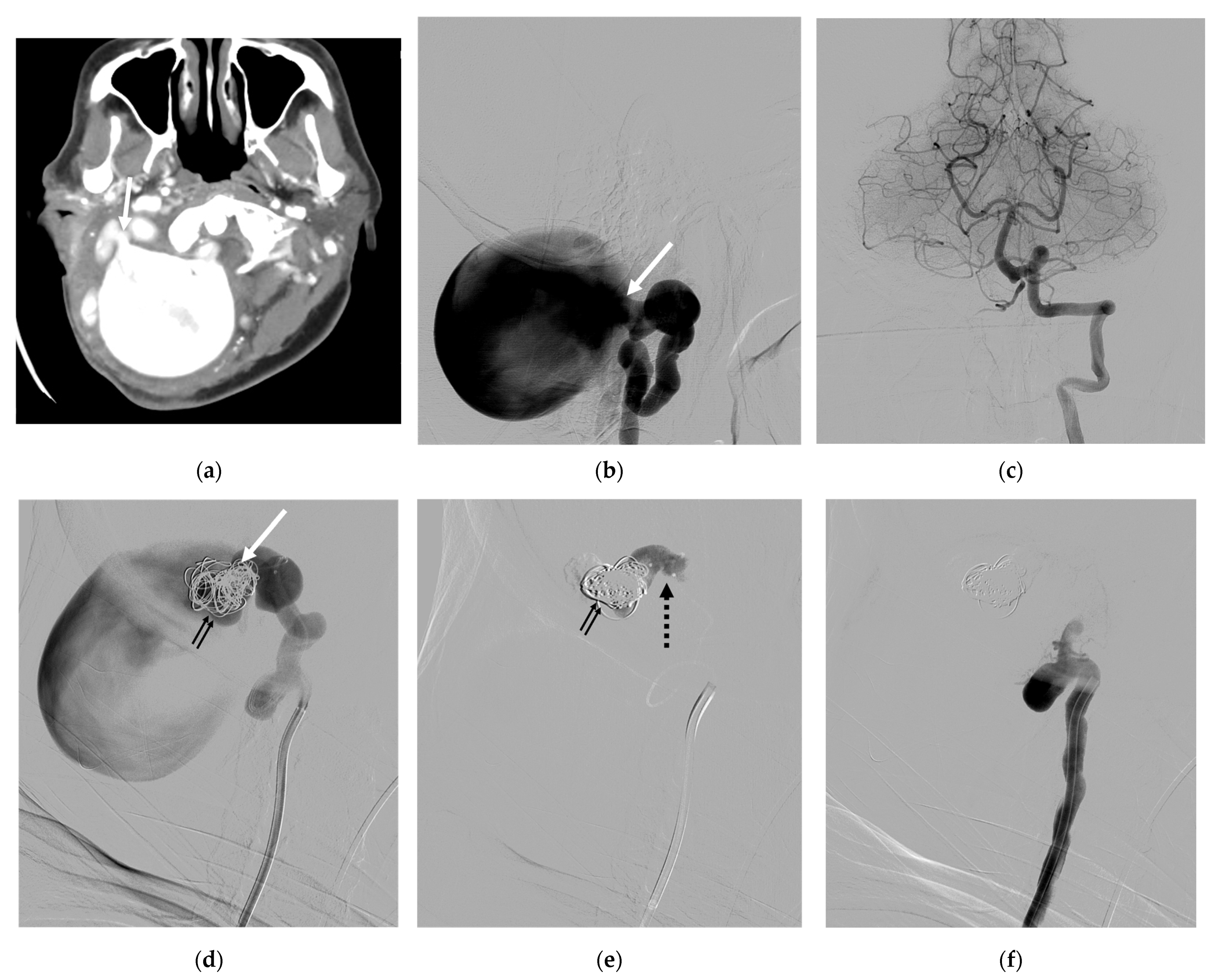 Diagnostics 14 00414 g004