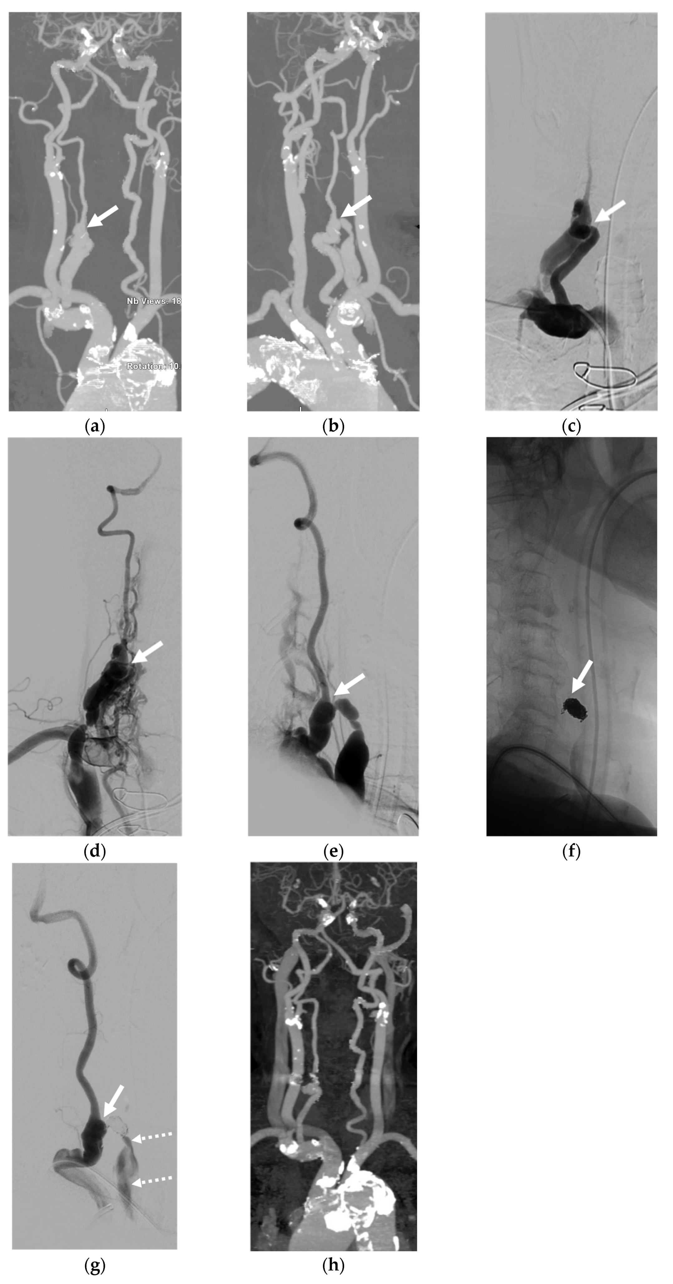 Diagnostics 14 00414 g006