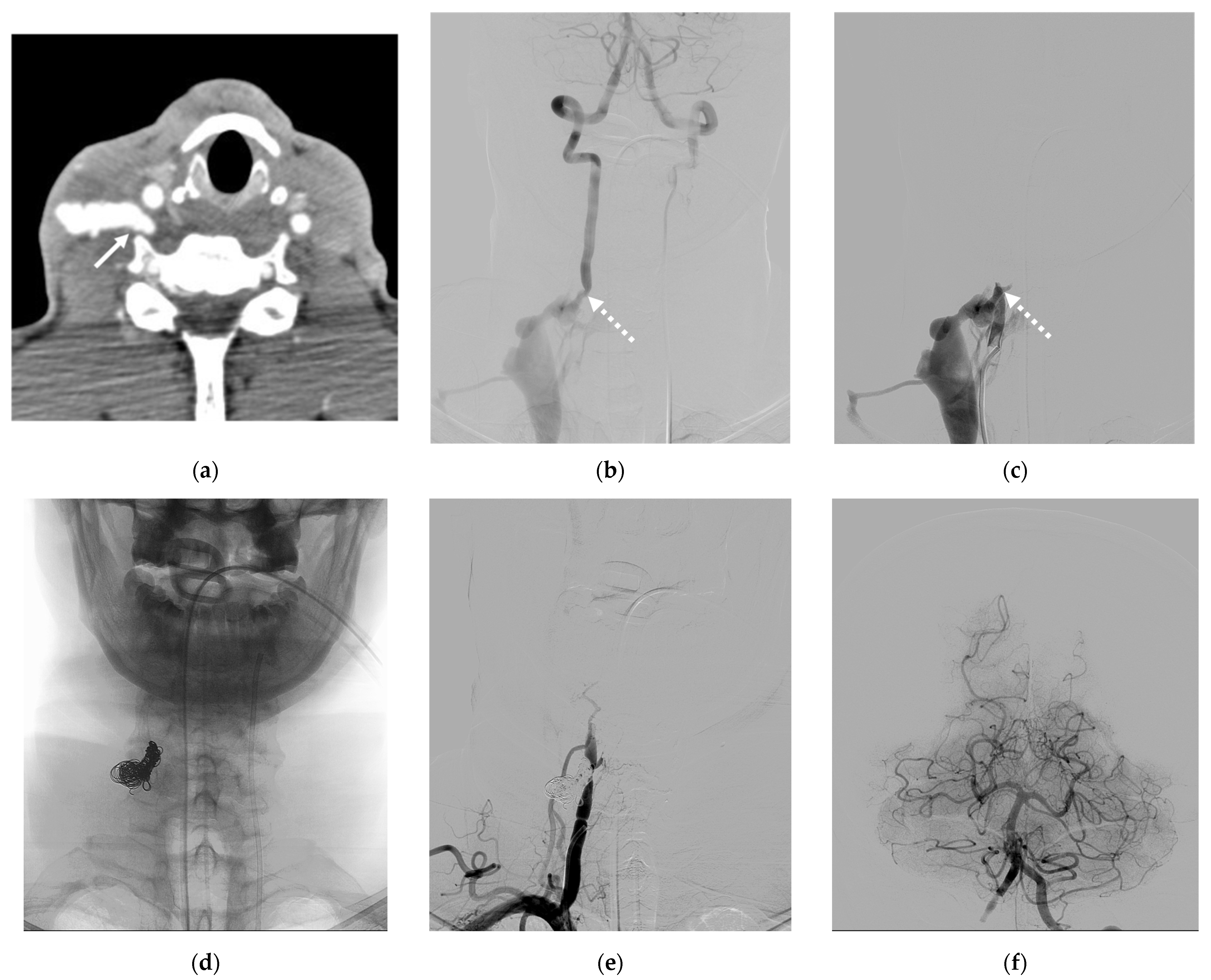 Diagnostics 14 00414 g007