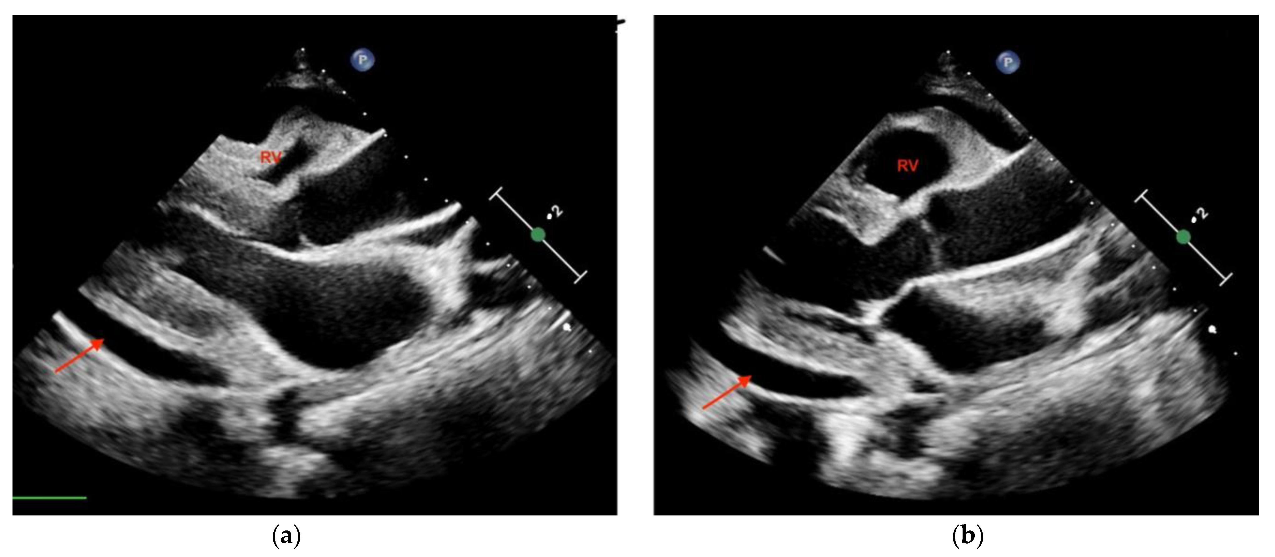 Diagnostics | Free Full-Text | Point-of-Care Ultrasound (POCUS) in ...