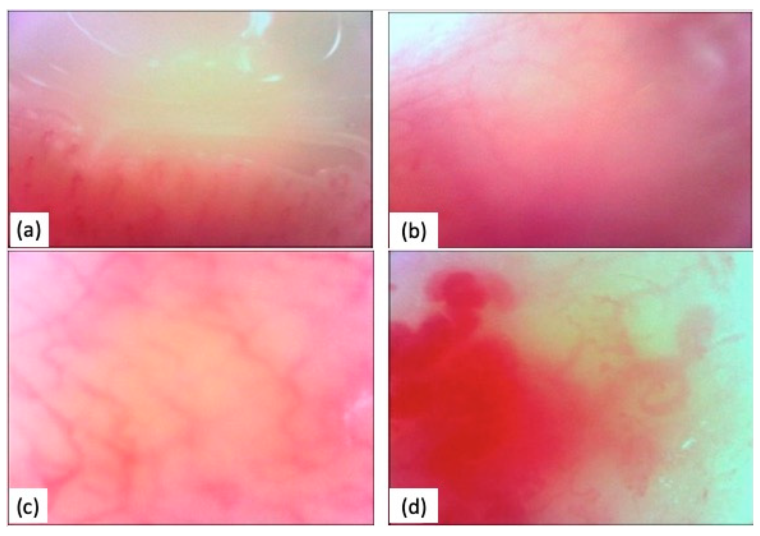 Diagnostics 14 00437 g002 Diagnostics 14 00437 g002