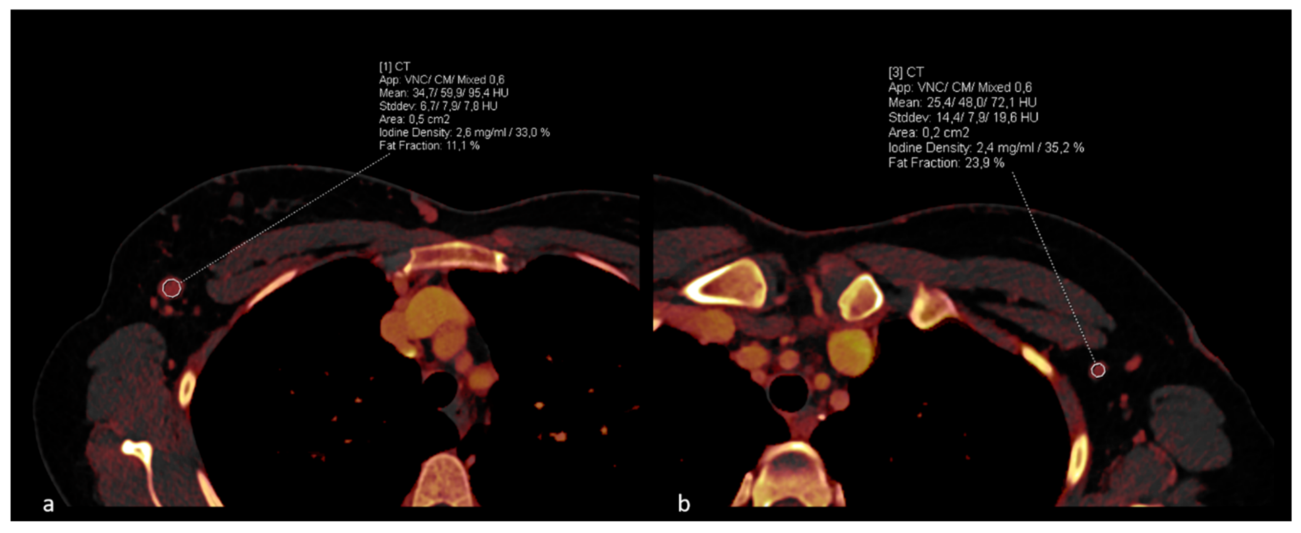 Diagnostics 14 00466 g002