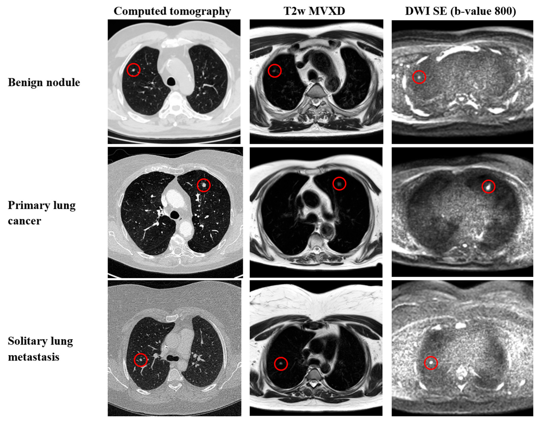 Diagnostics 14 00483 g002