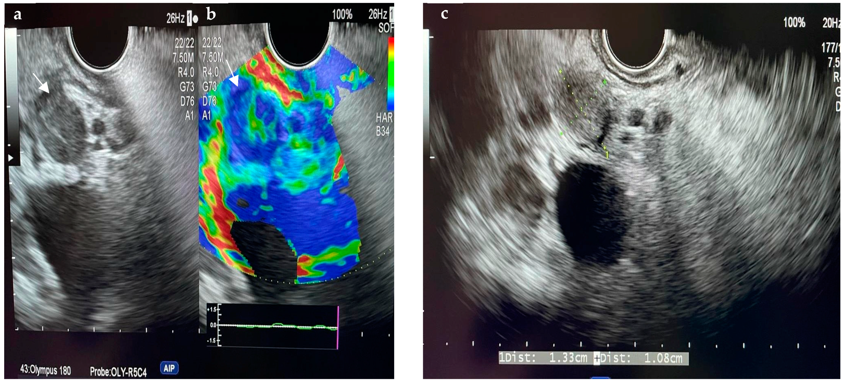 Diagnostics 14 00490 g001