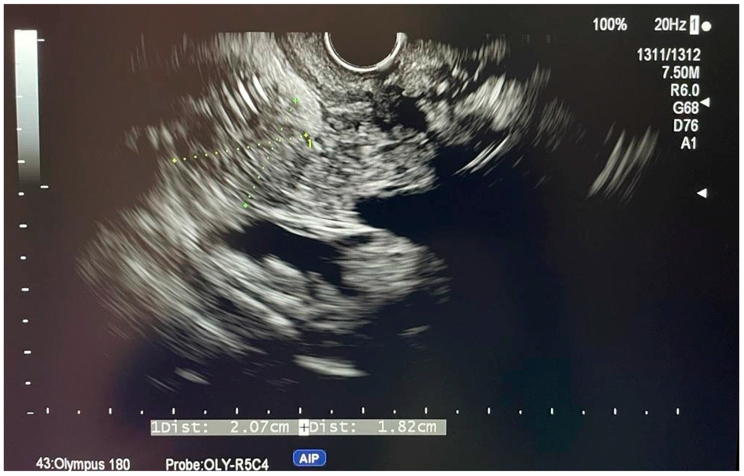 Diagnostics 14 00490 g002