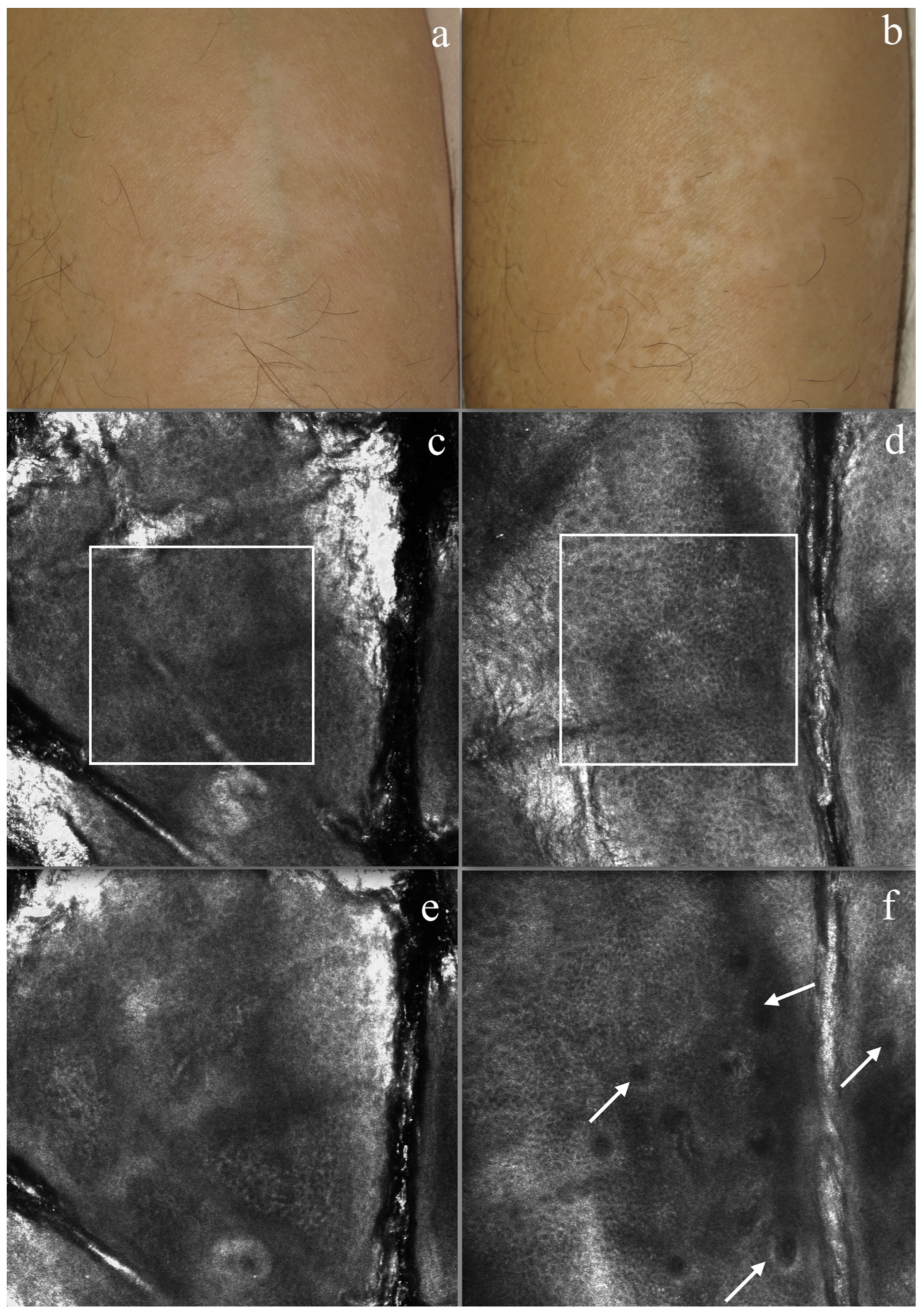 Diagnostics 14 00494 g002