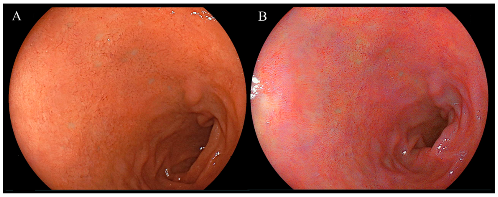 Diagnostics 14 00508 g002