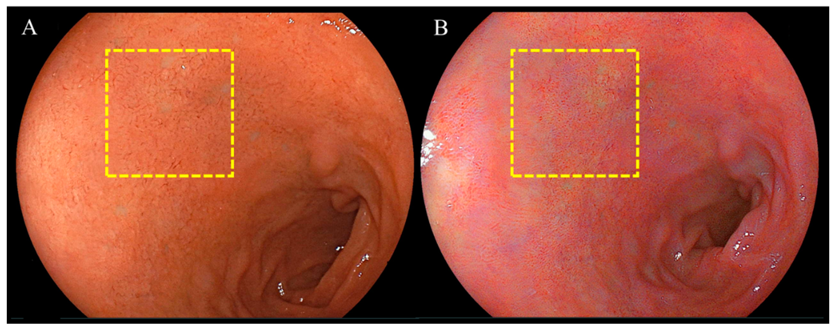Diagnostics 14 00508 g004