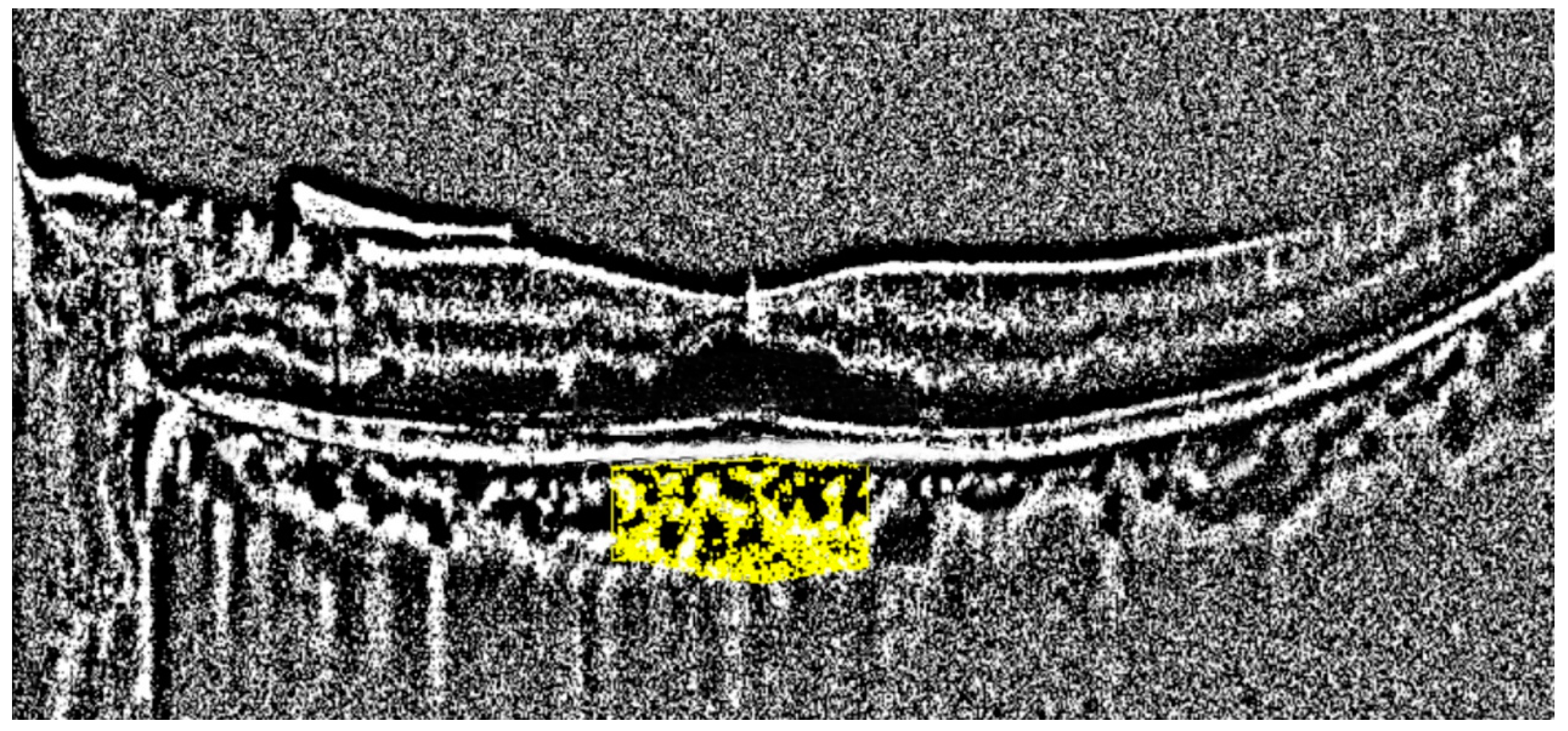 Diagnostics 14 00537 g003