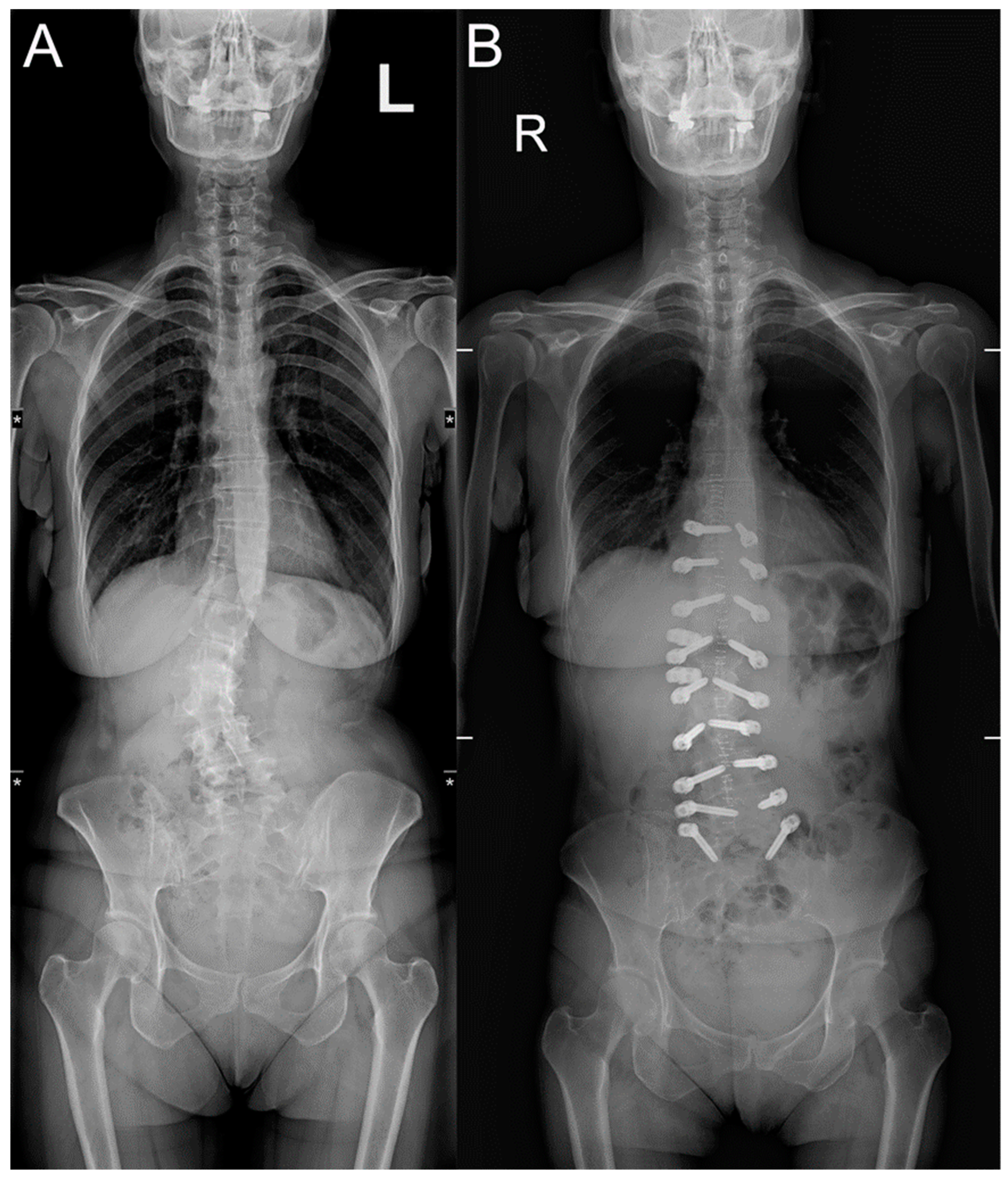 Diagnostics 14 00549 g003