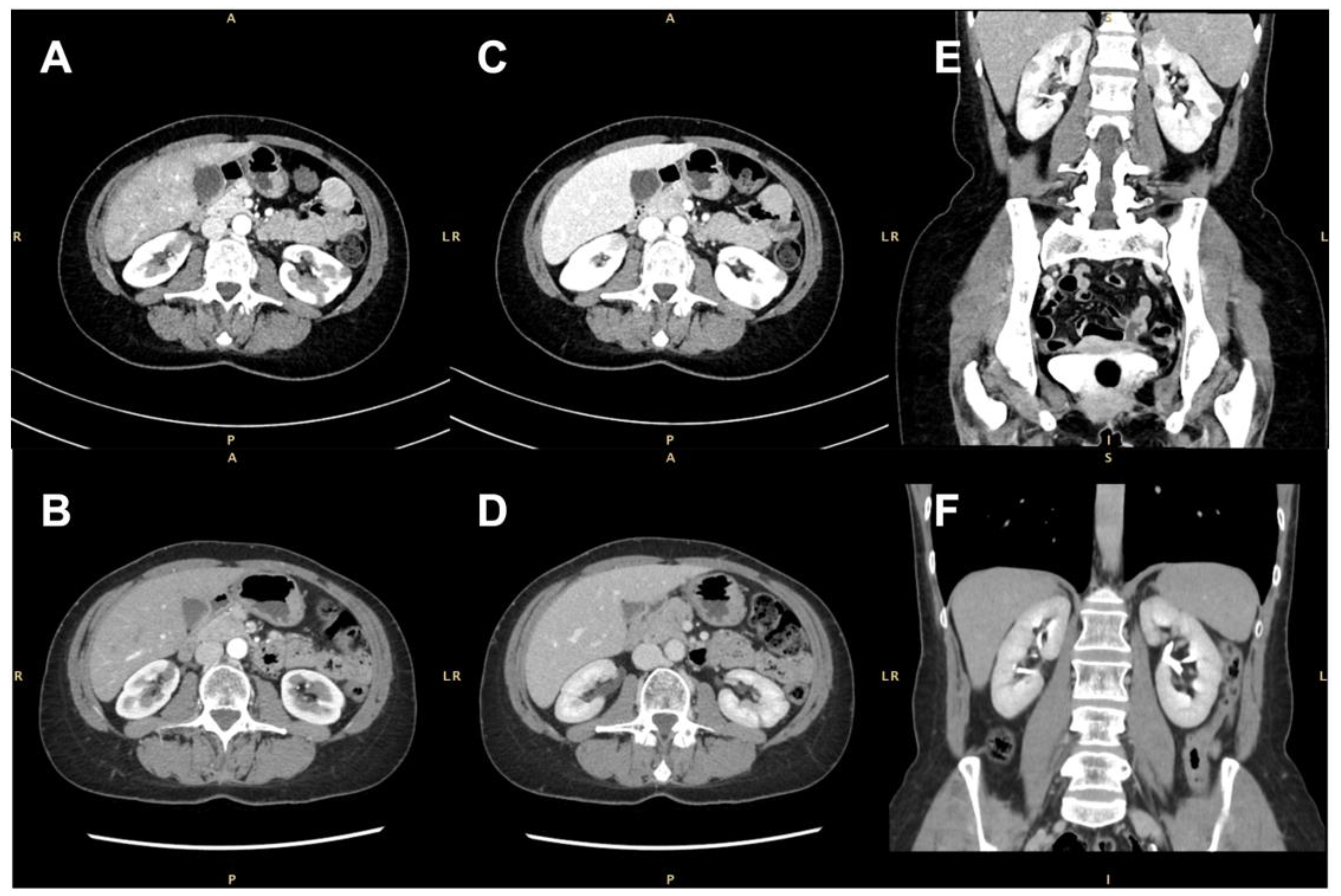 Diagnostics 14 00566 g002 Diagnostics 14 00566 g002