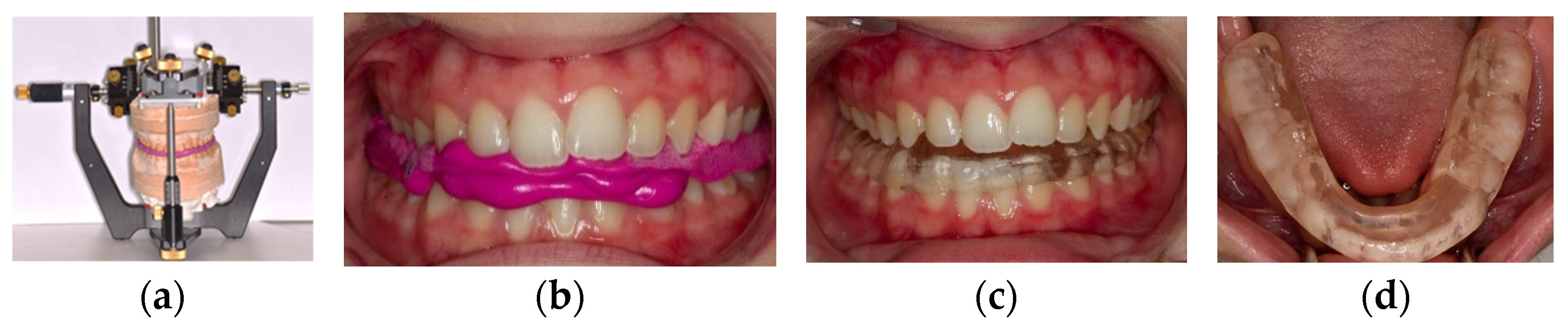 Diagnostics 14 00572 g005