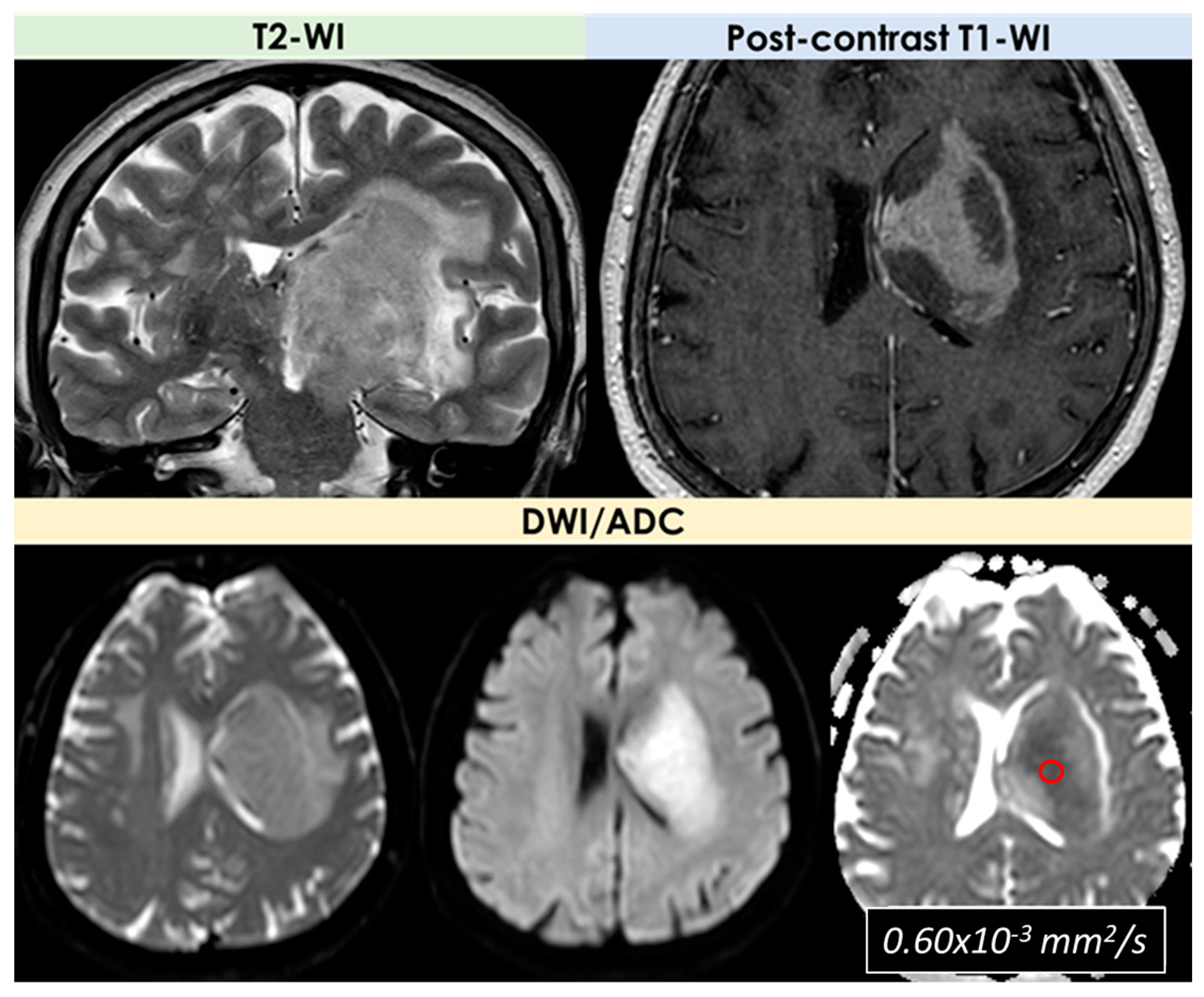 Diagnostics 14 00618 g005