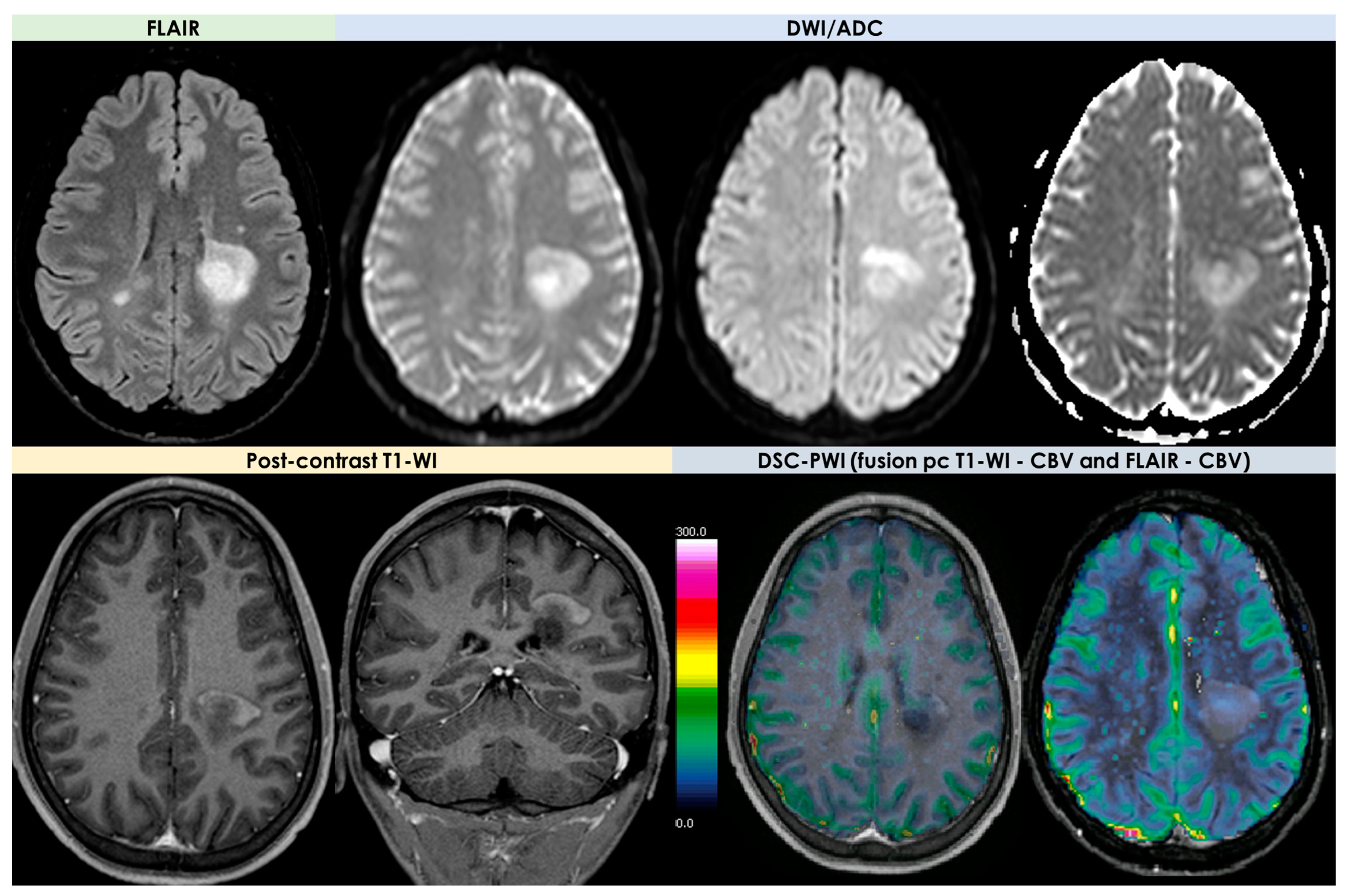 Diagnostics 14 00618 g007
