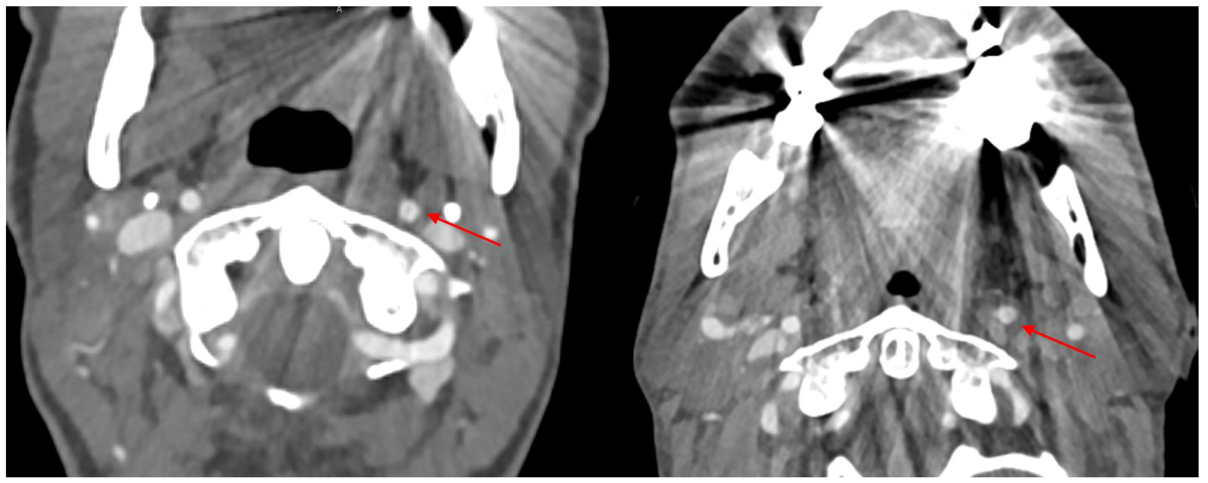 Diagnostics 14 00626 g001
