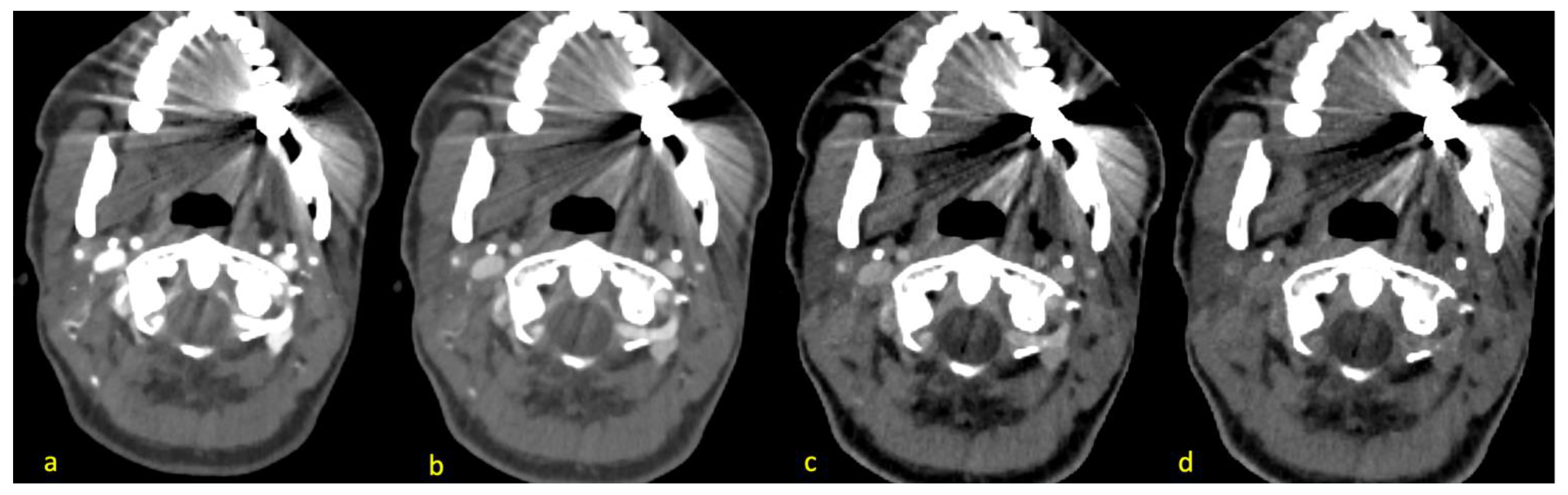 Diagnostics 14 00626 g002