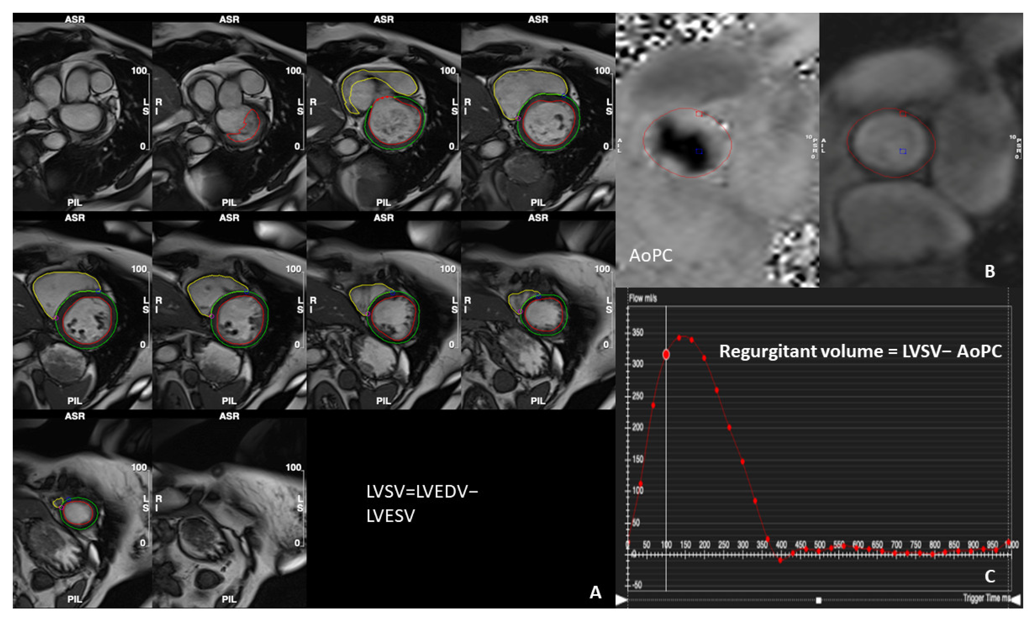 Diagnostics 14 00644 g003