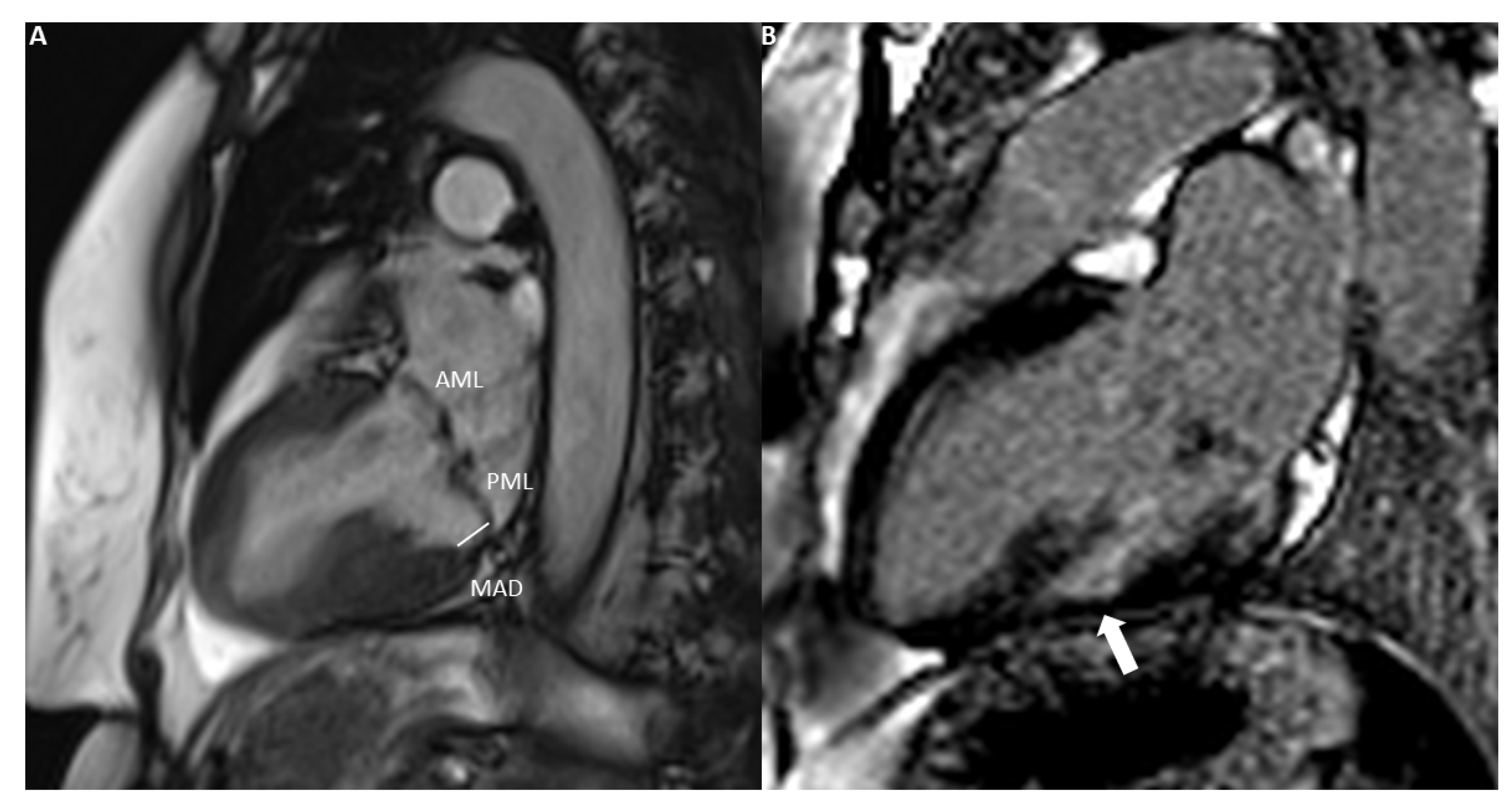 Diagnostics 14 00644 g004