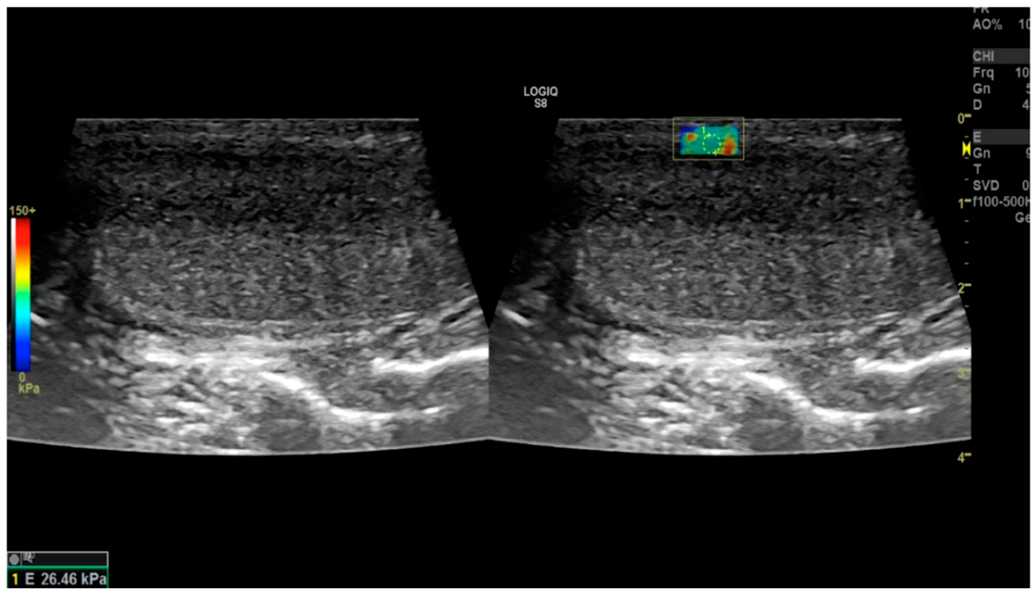 Diagnostics 14 00665 g003