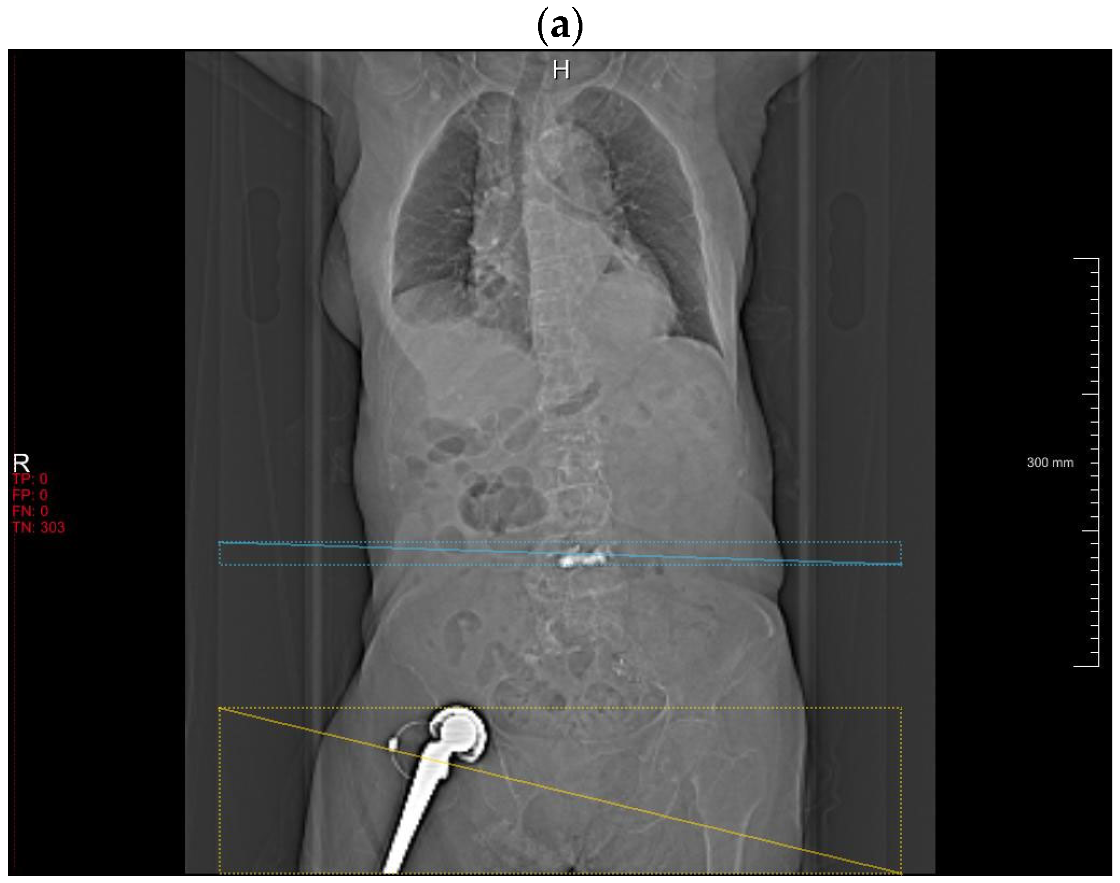 Diagnostics 14 00668 g002a