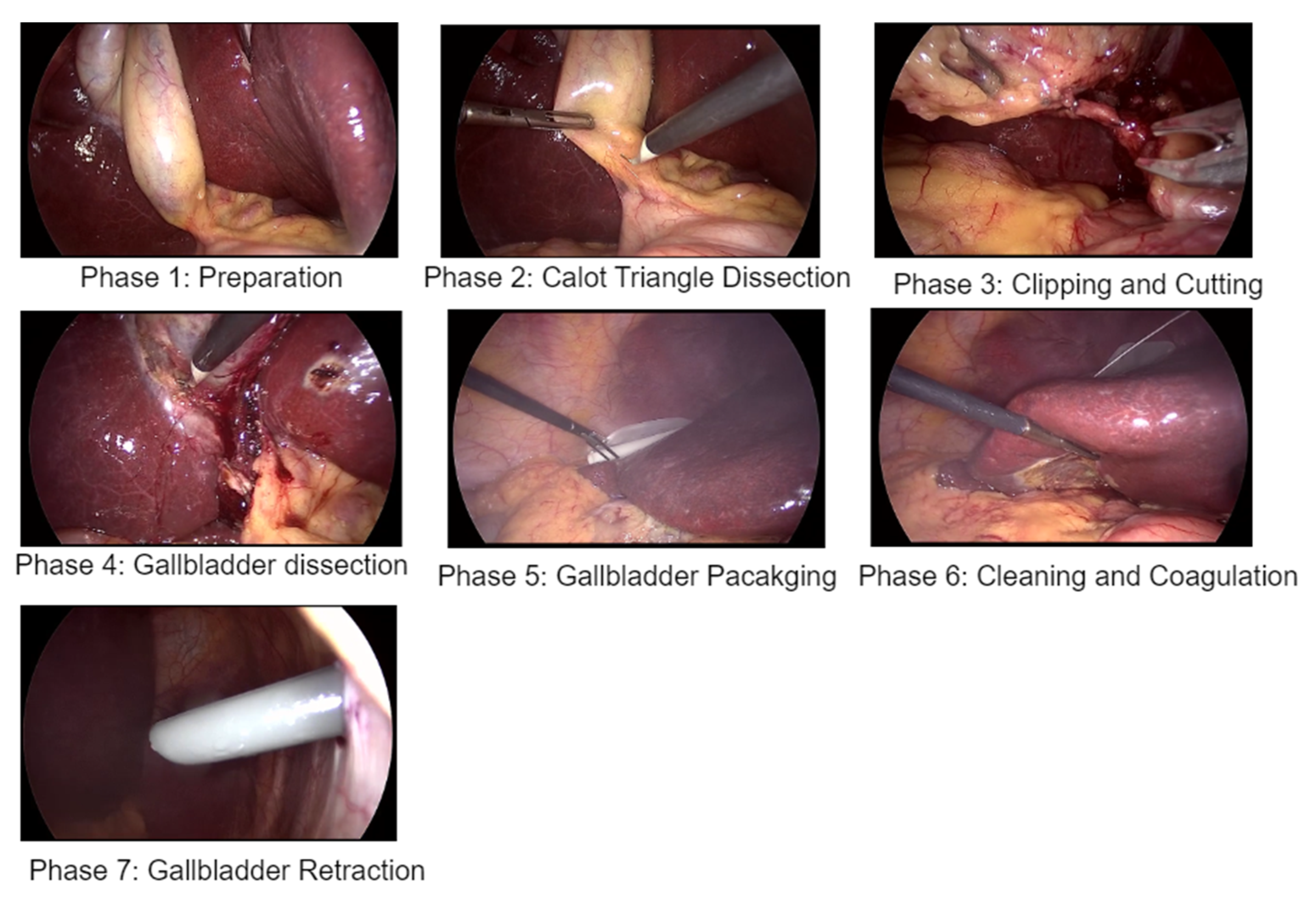 Diagnostics 14 00681 g003