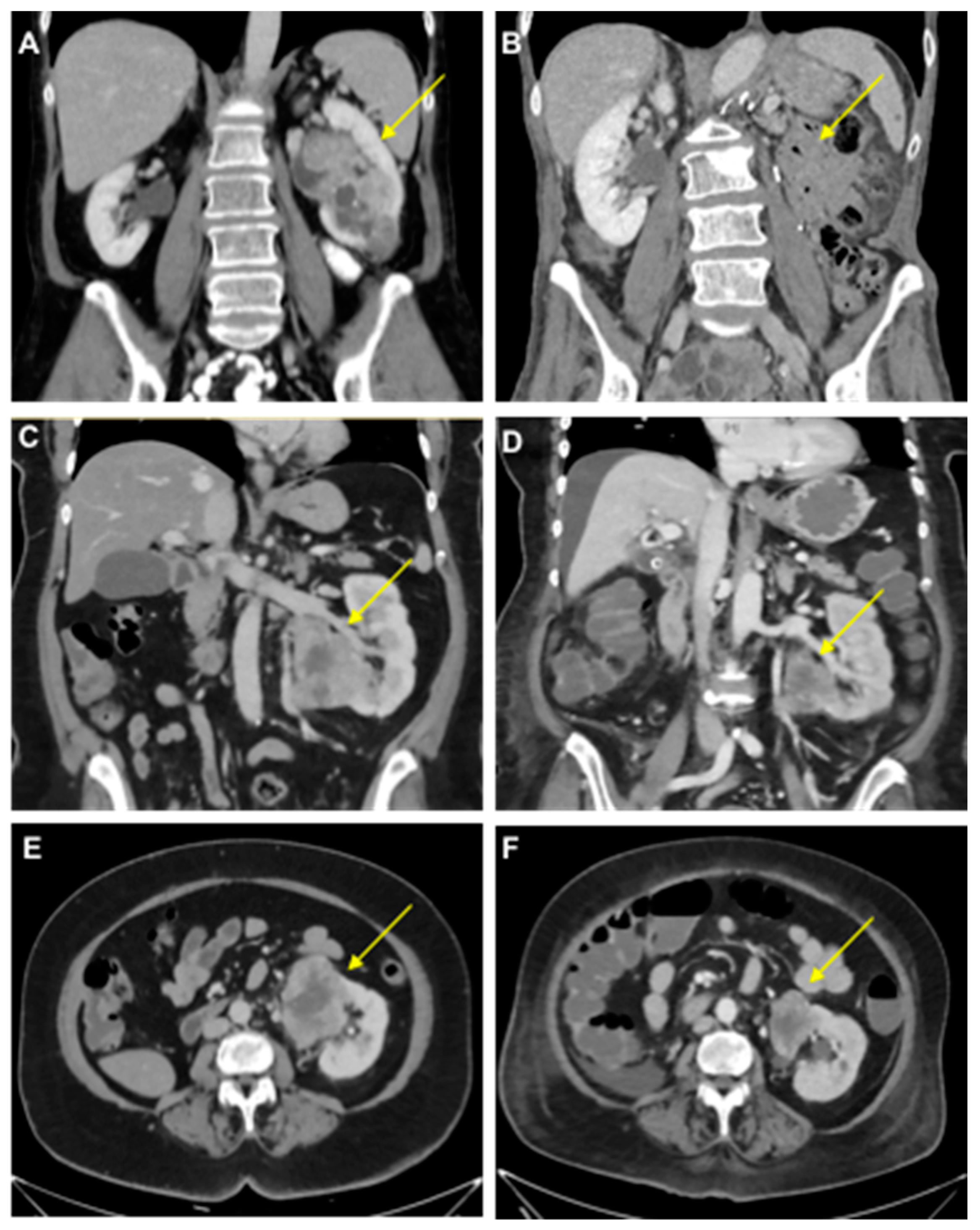 Diagnostics 14 00741 g001