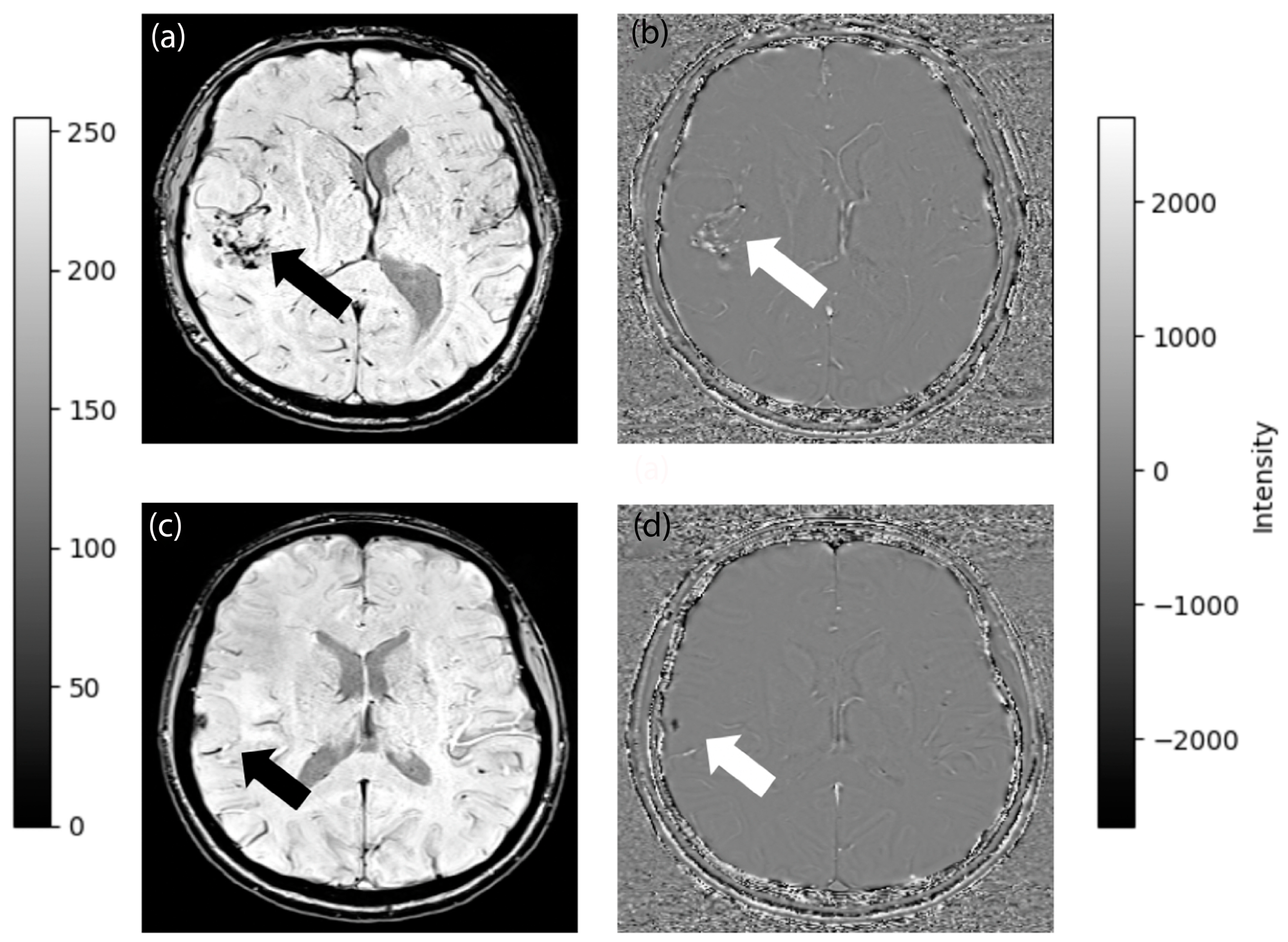 Diagnostics 14 00748 g002 Diagnostics 14 00748 g002