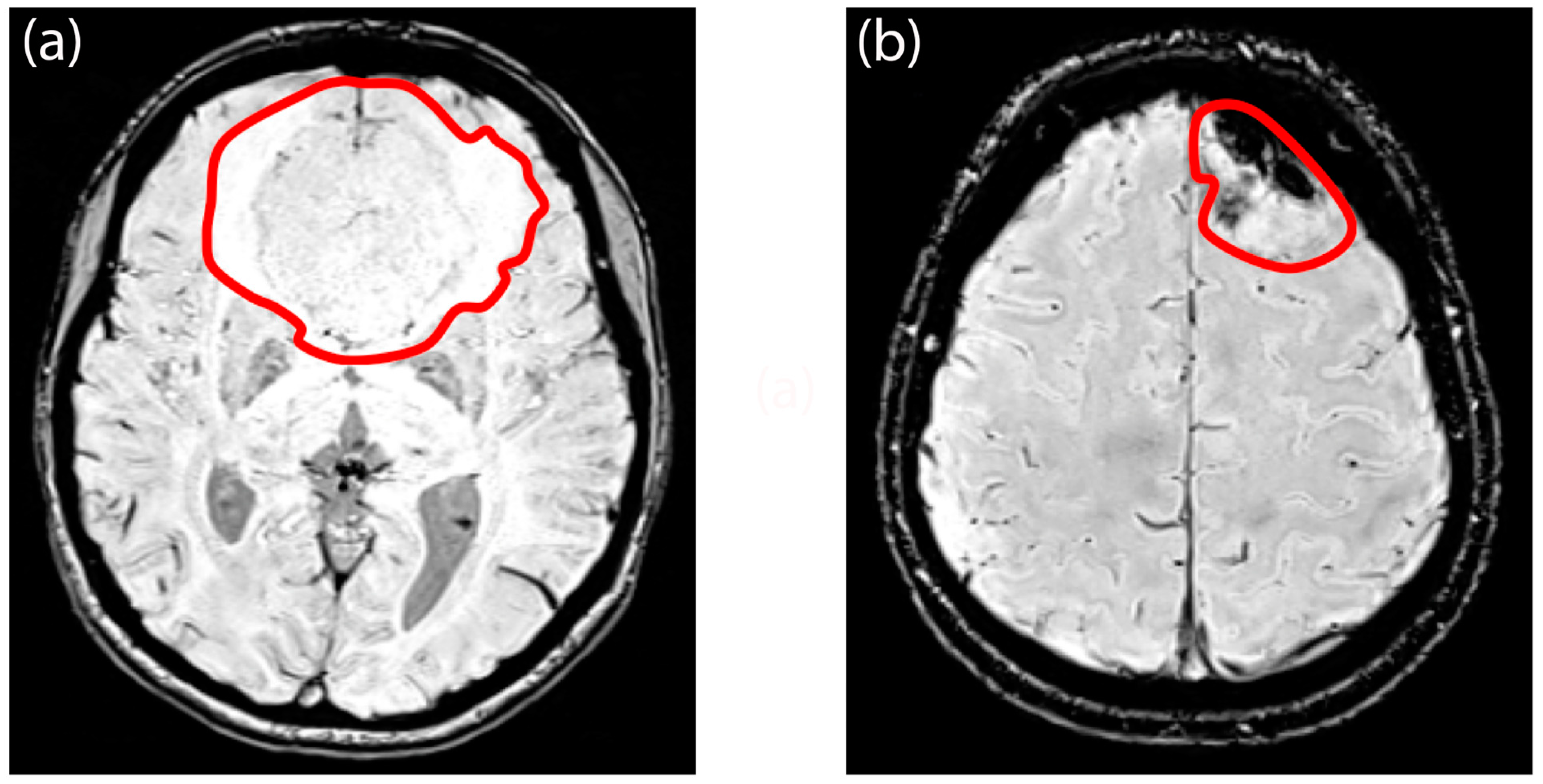 Diagnostics 14 00748 g007 Diagnostics 14 00748 g007