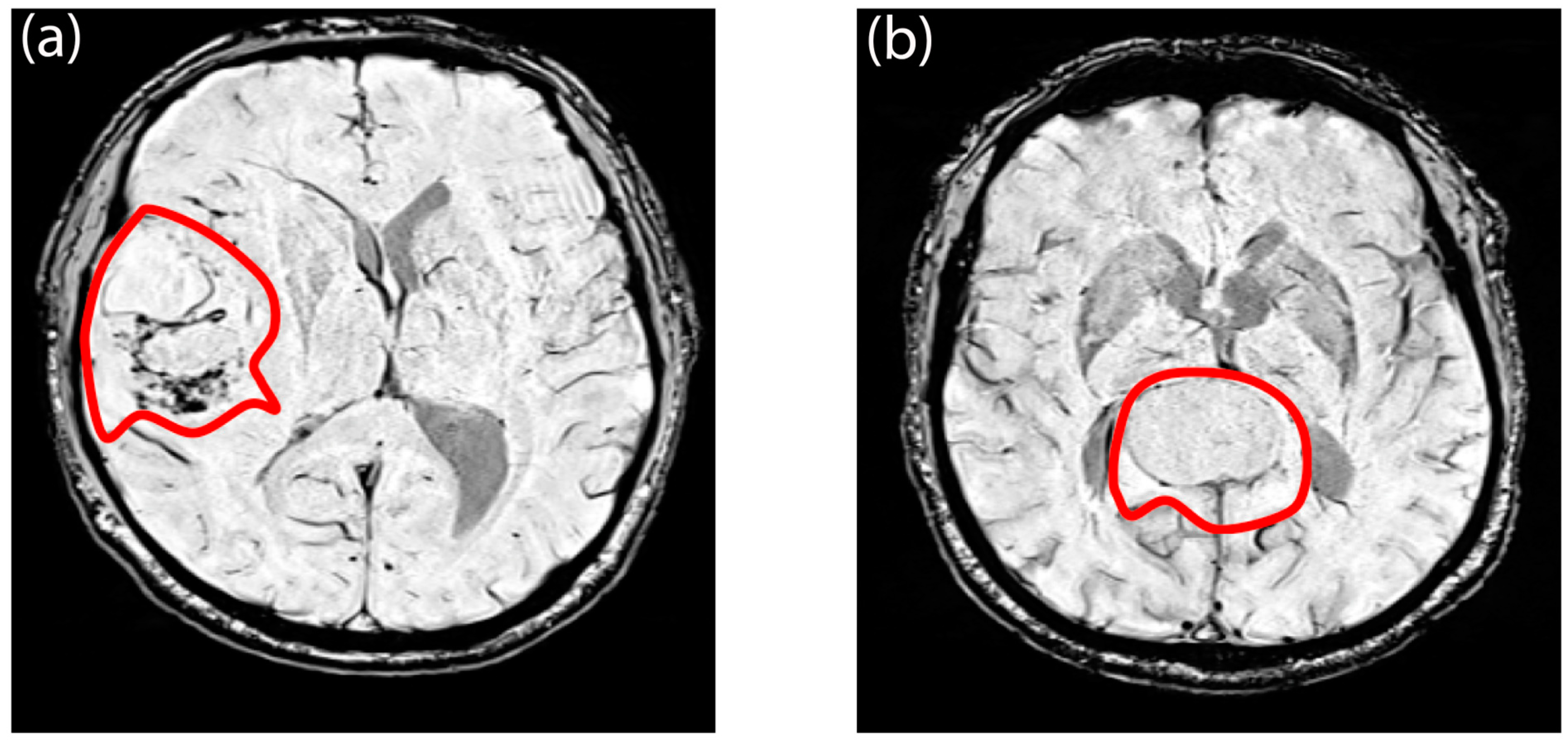 Diagnostics 14 00748 g008 Diagnostics 14 00748 g008