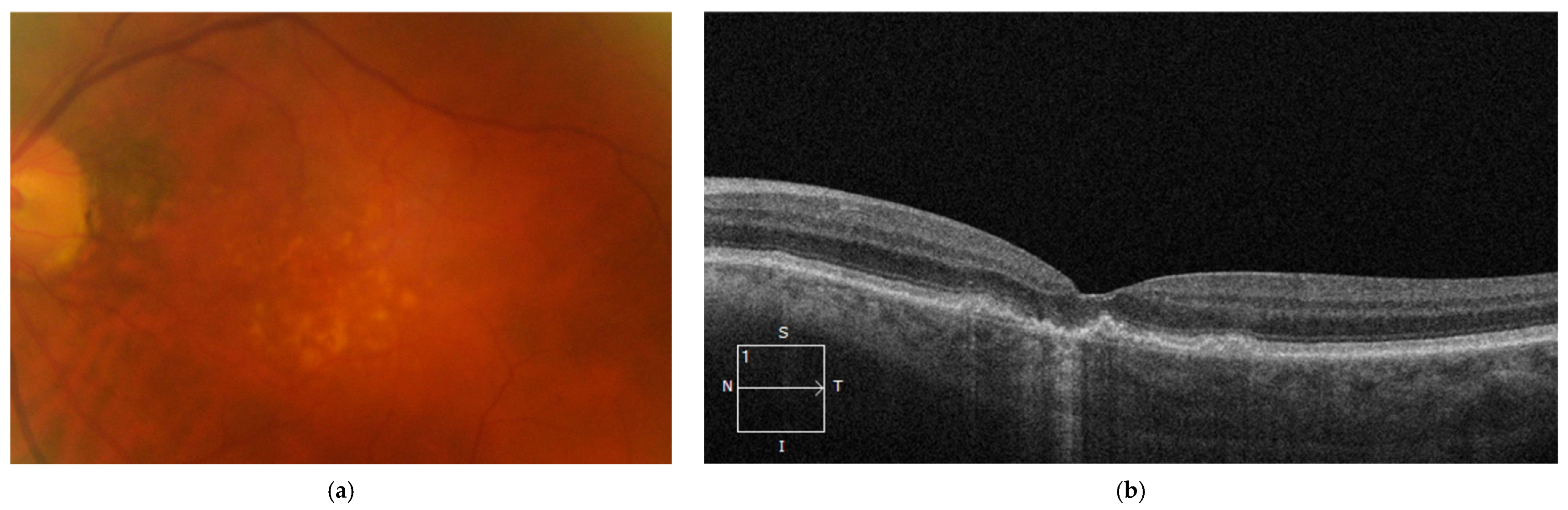 Diagnostics 14 00764 g002