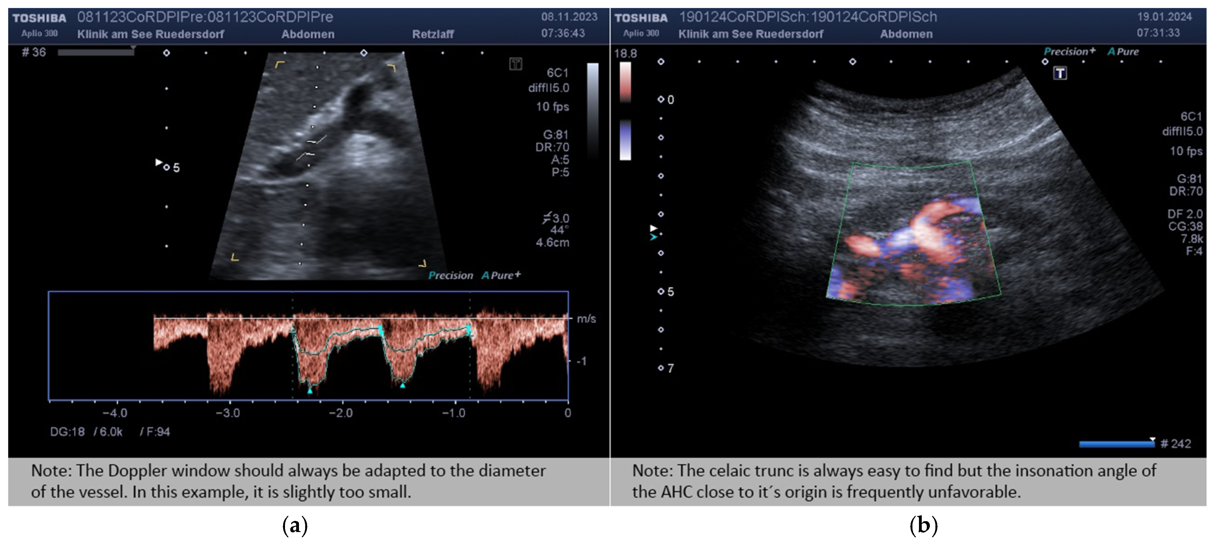 Diagnostics 14 00778 g003 Diagnostics 14 00778 g003