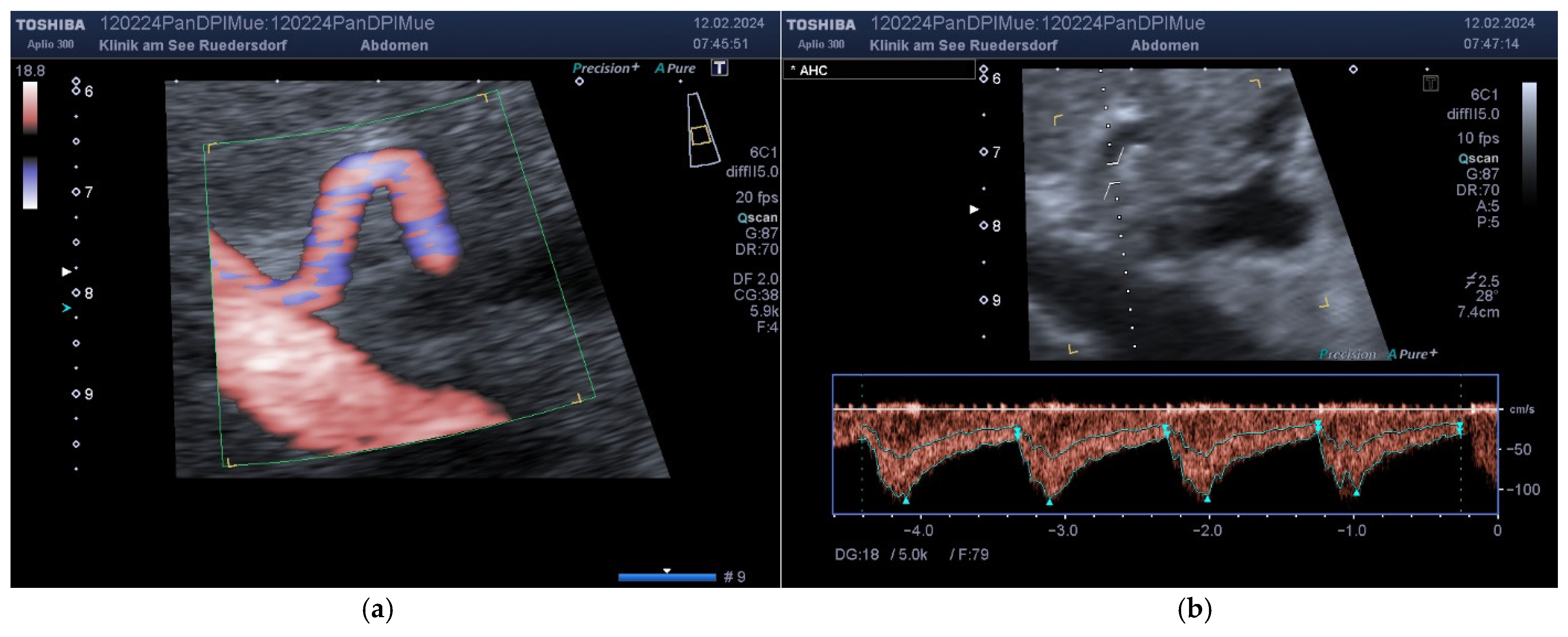 Diagnostics 14 00778 g005a Diagnostics 14 00778 g005a
