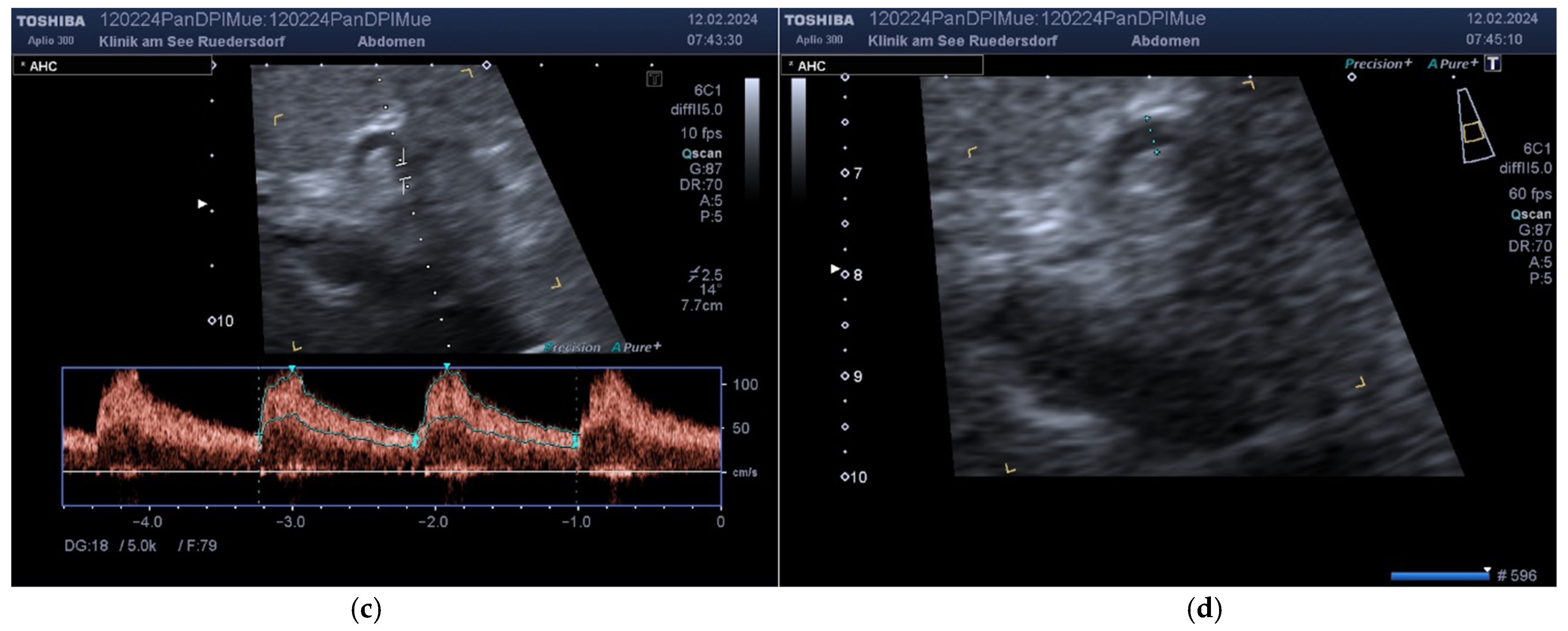 Diagnostics 14 00778 g005b Diagnostics 14 00778 g005b