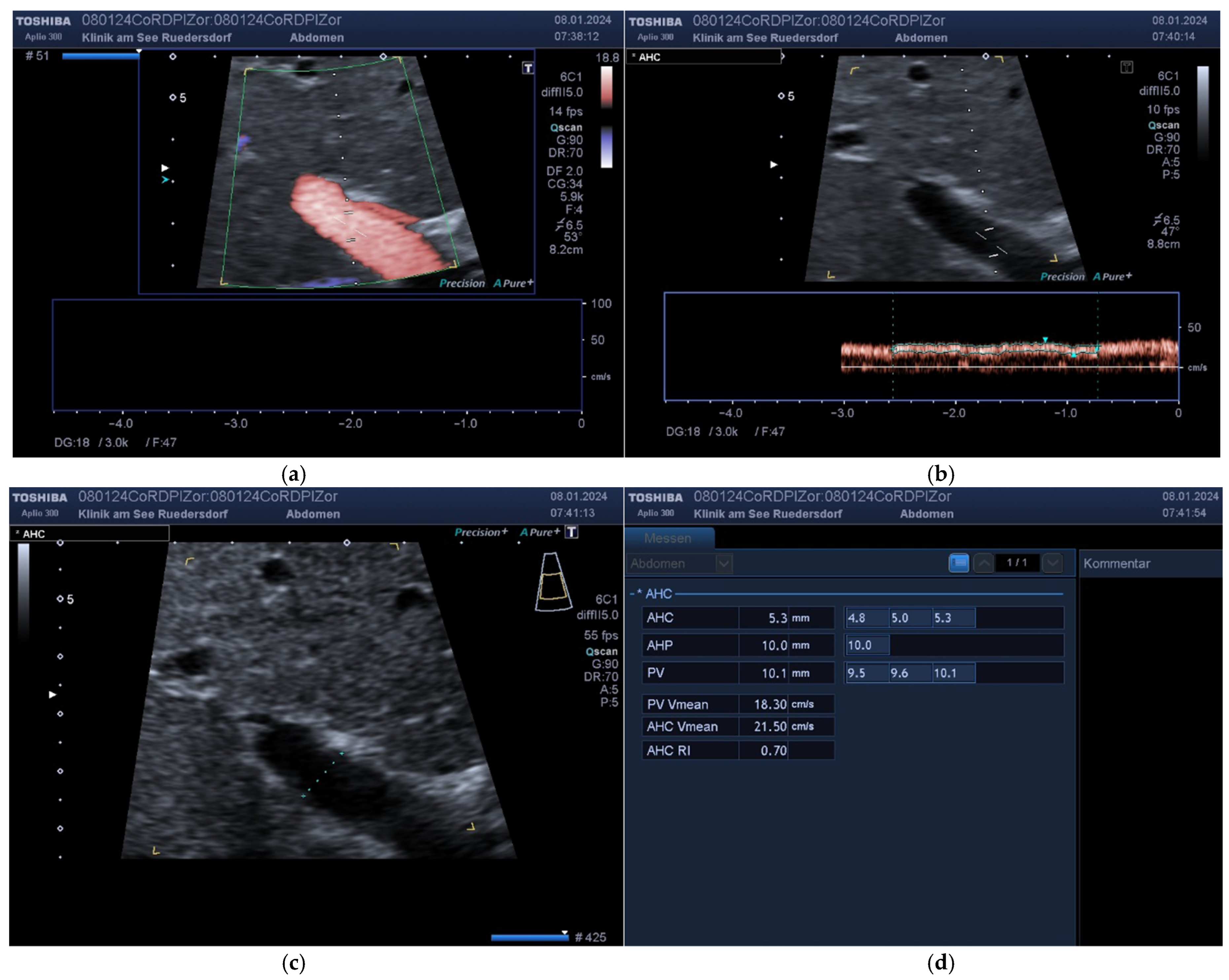 Diagnostics 14 00778 g006 Diagnostics 14 00778 g006