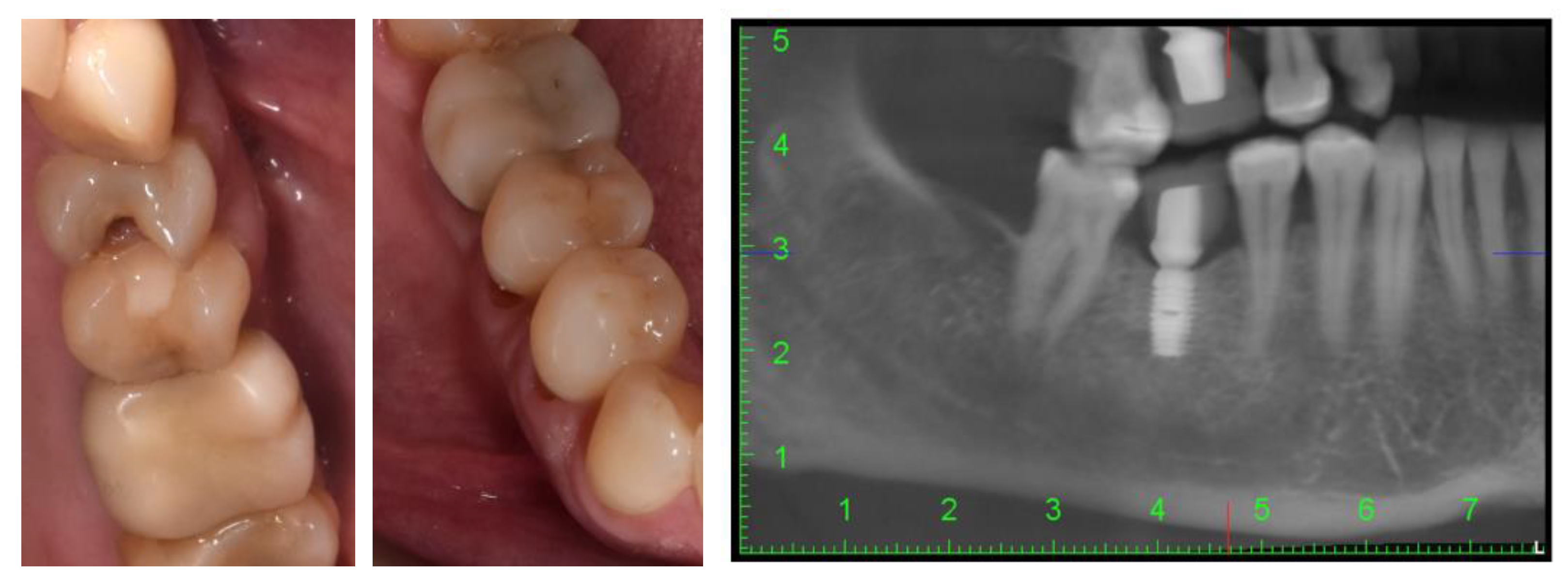 Diagnostics 14 00788 g001