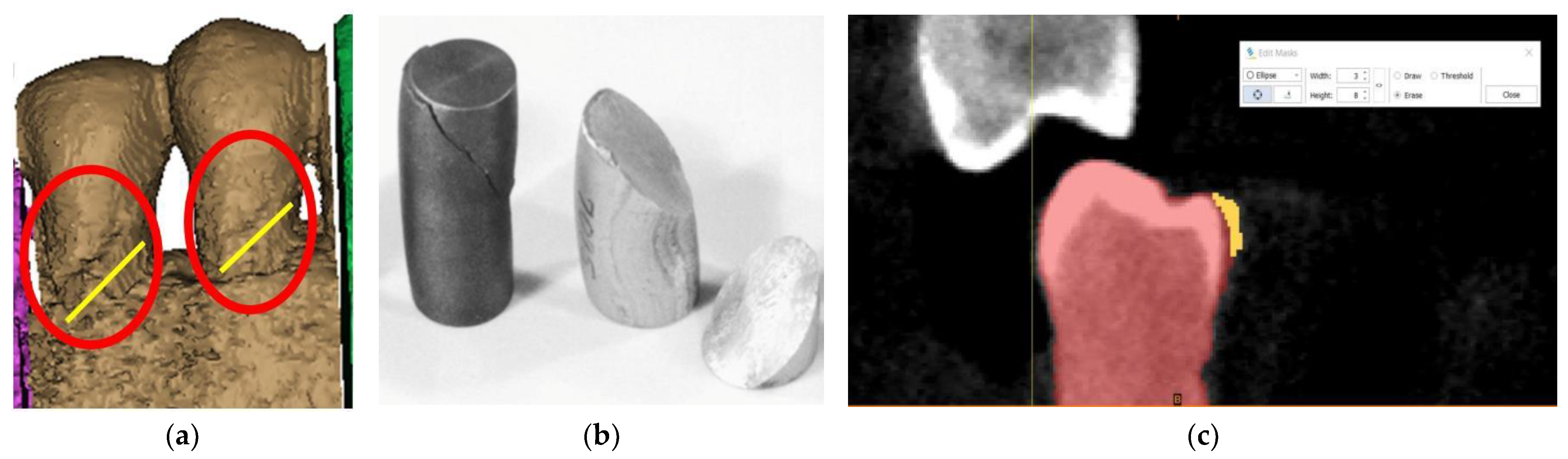 Diagnostics 14 00788 g004