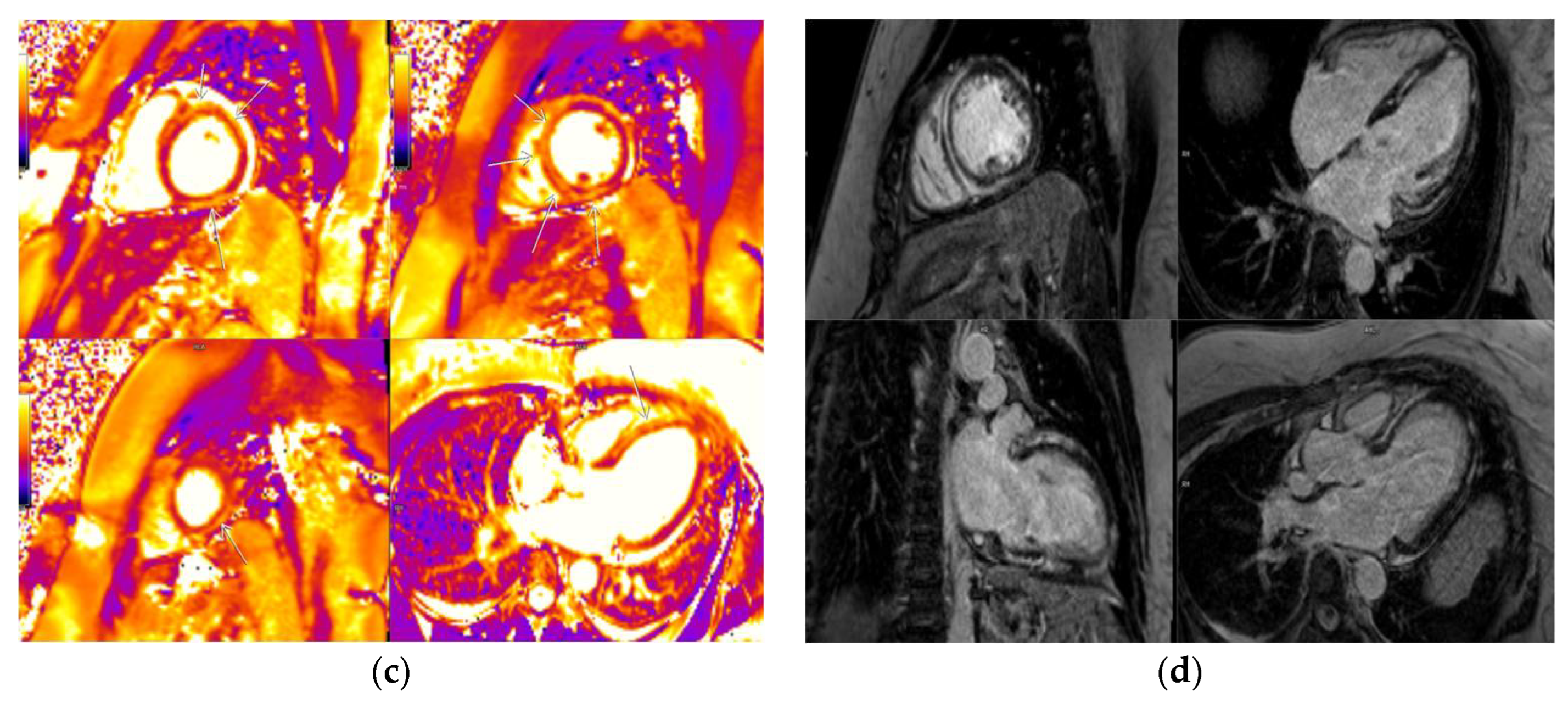 Diagnostics 14 00790 g001b