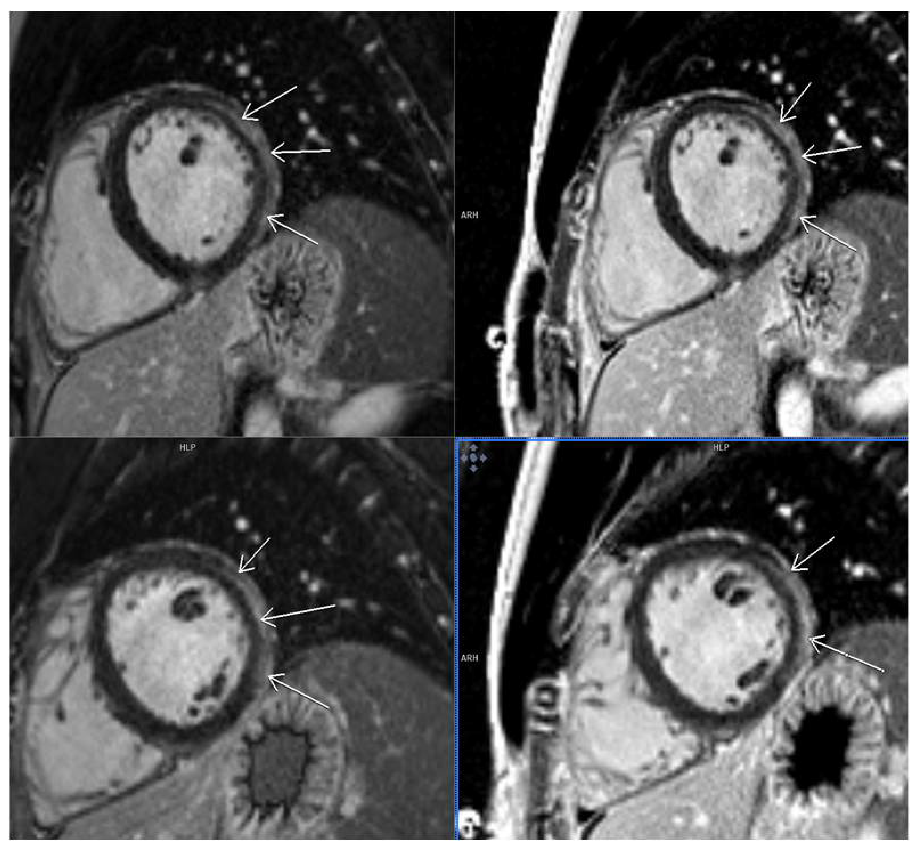 Diagnostics 14 00790 g002