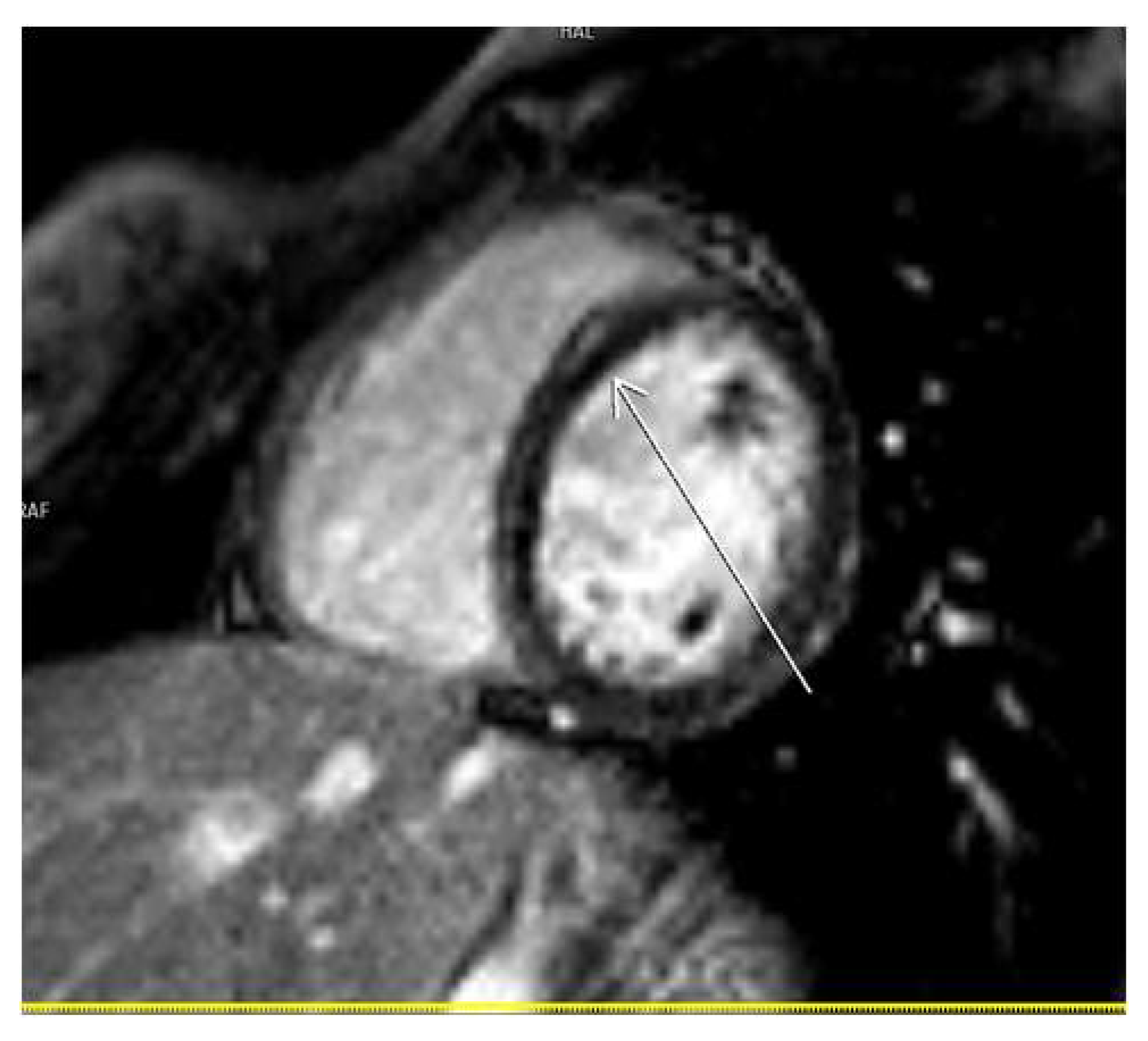 Diagnostics 14 00790 g003