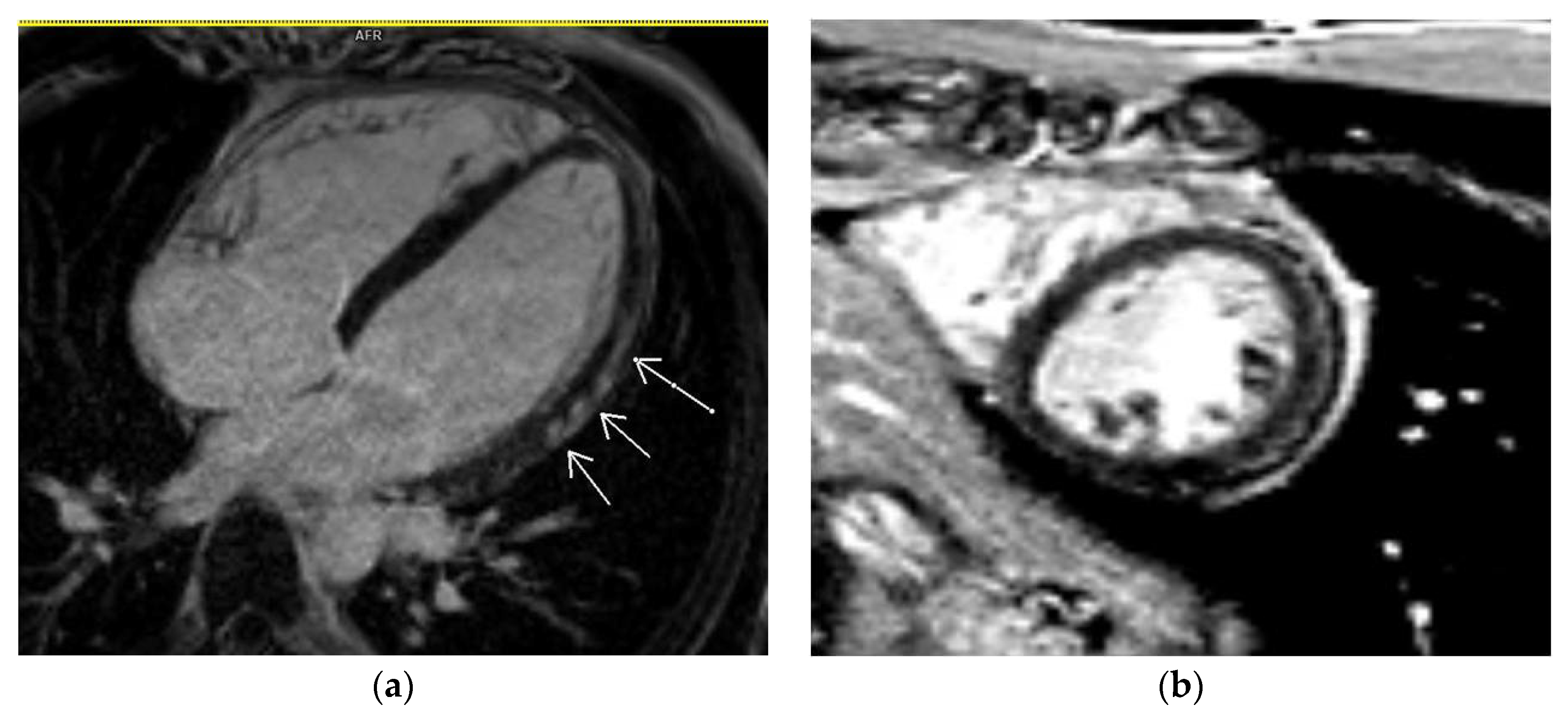 Diagnostics 14 00790 g004