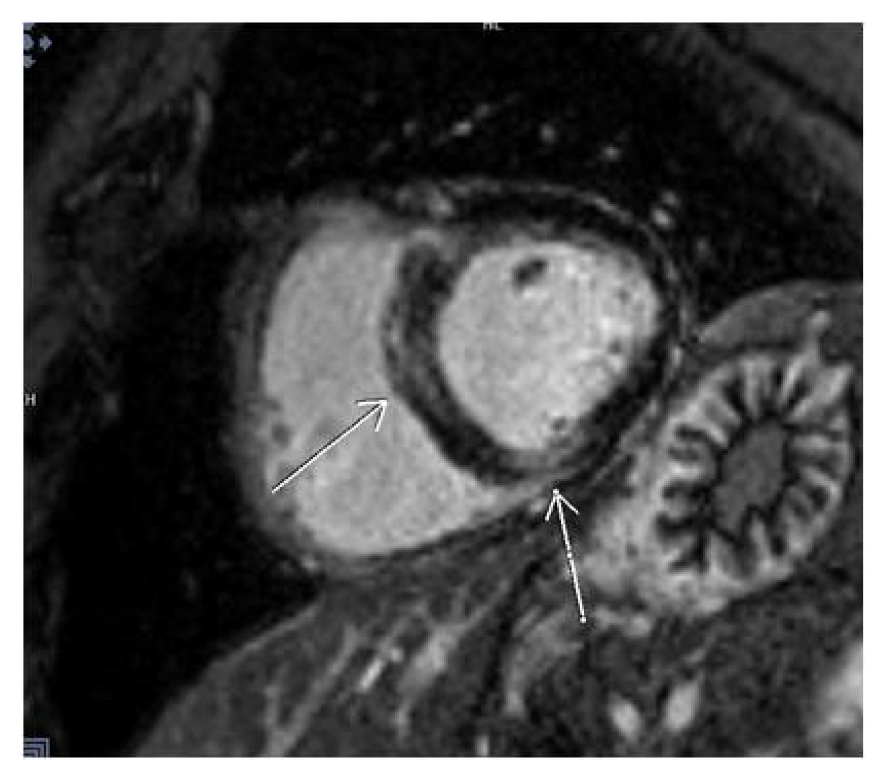 Diagnostics 14 00790 g005