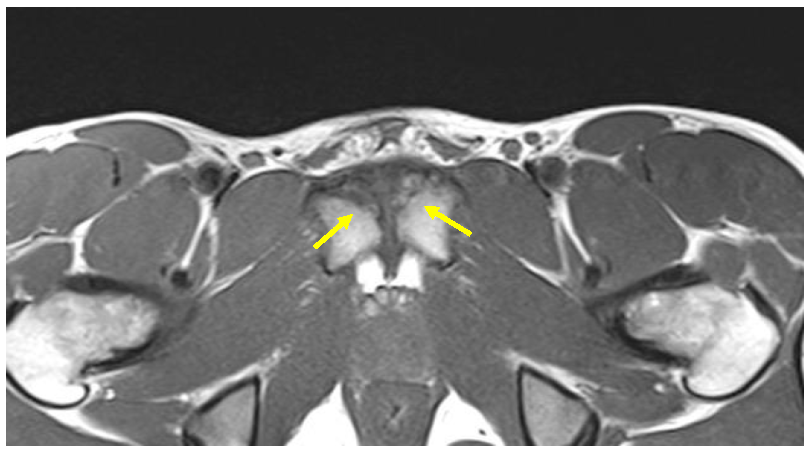 Diagnostics 14 00814 g015