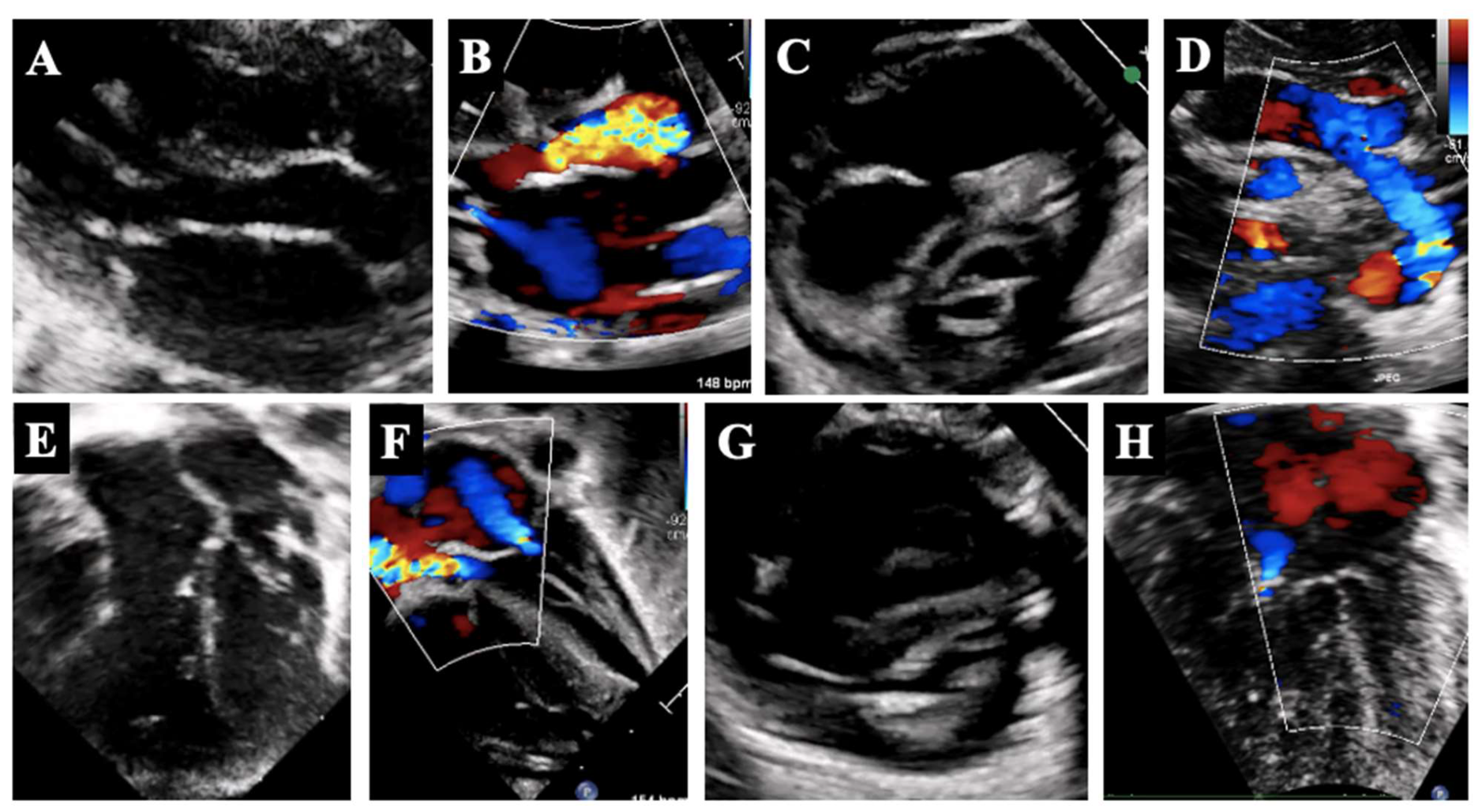 Diagnostics 14 00823 g001