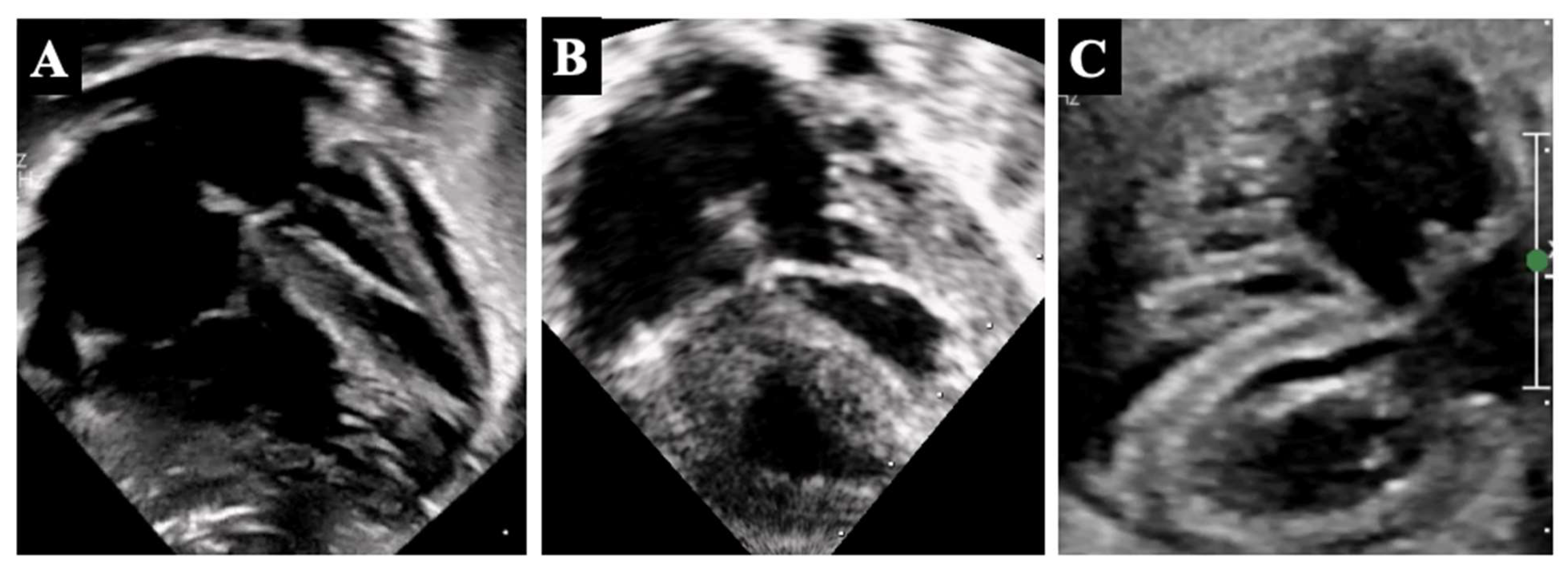 Diagnostics 14 00823 g002