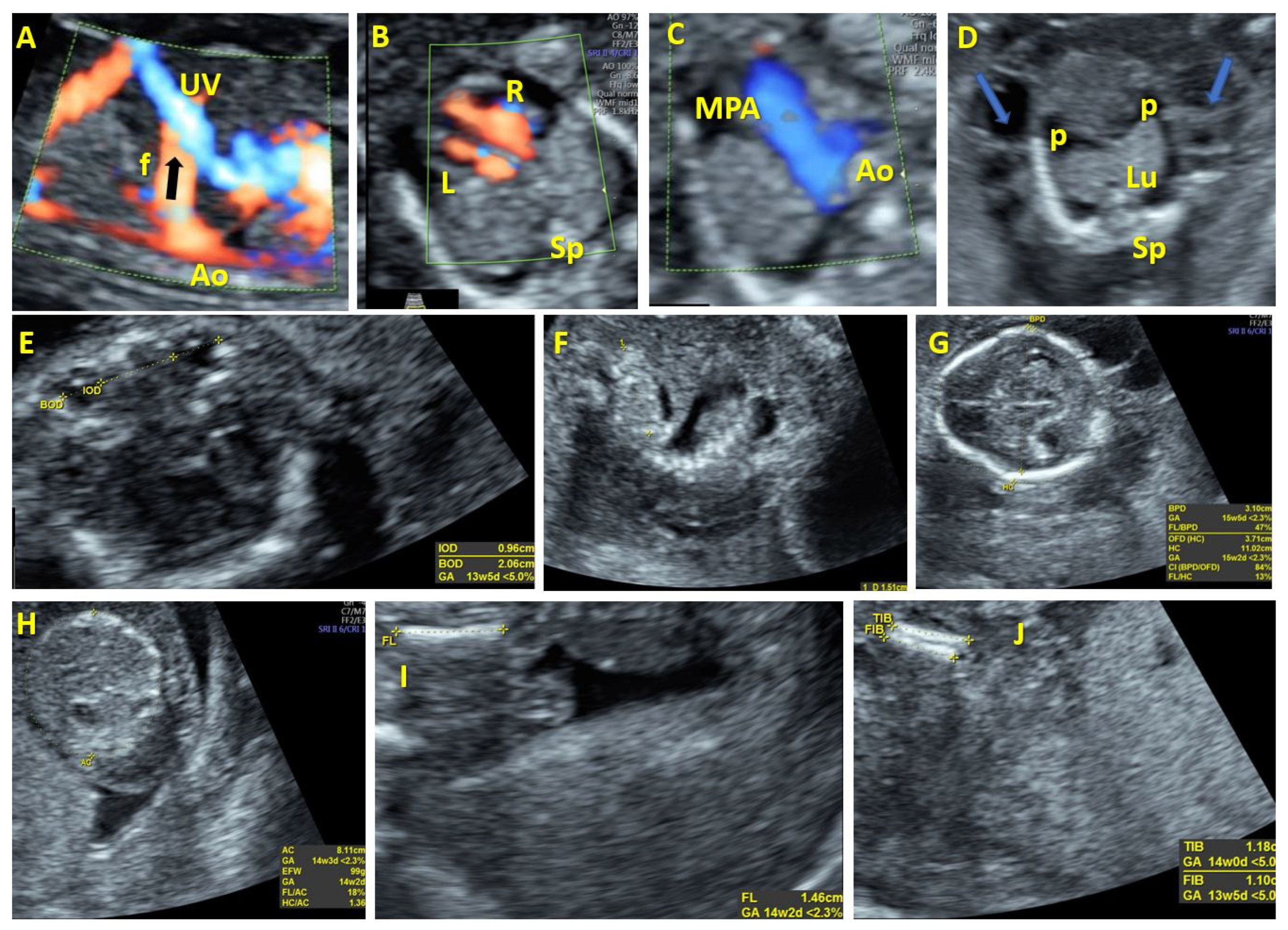 Diagnostics 14 00826 g001 Diagnostics 14 00826 g001