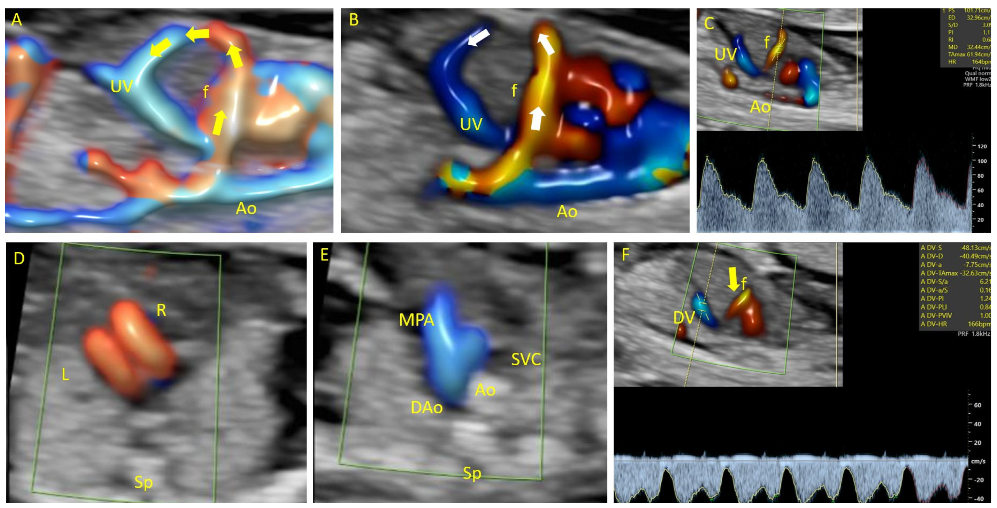 Diagnostics 14 00826 g002 Diagnostics 14 00826 g002