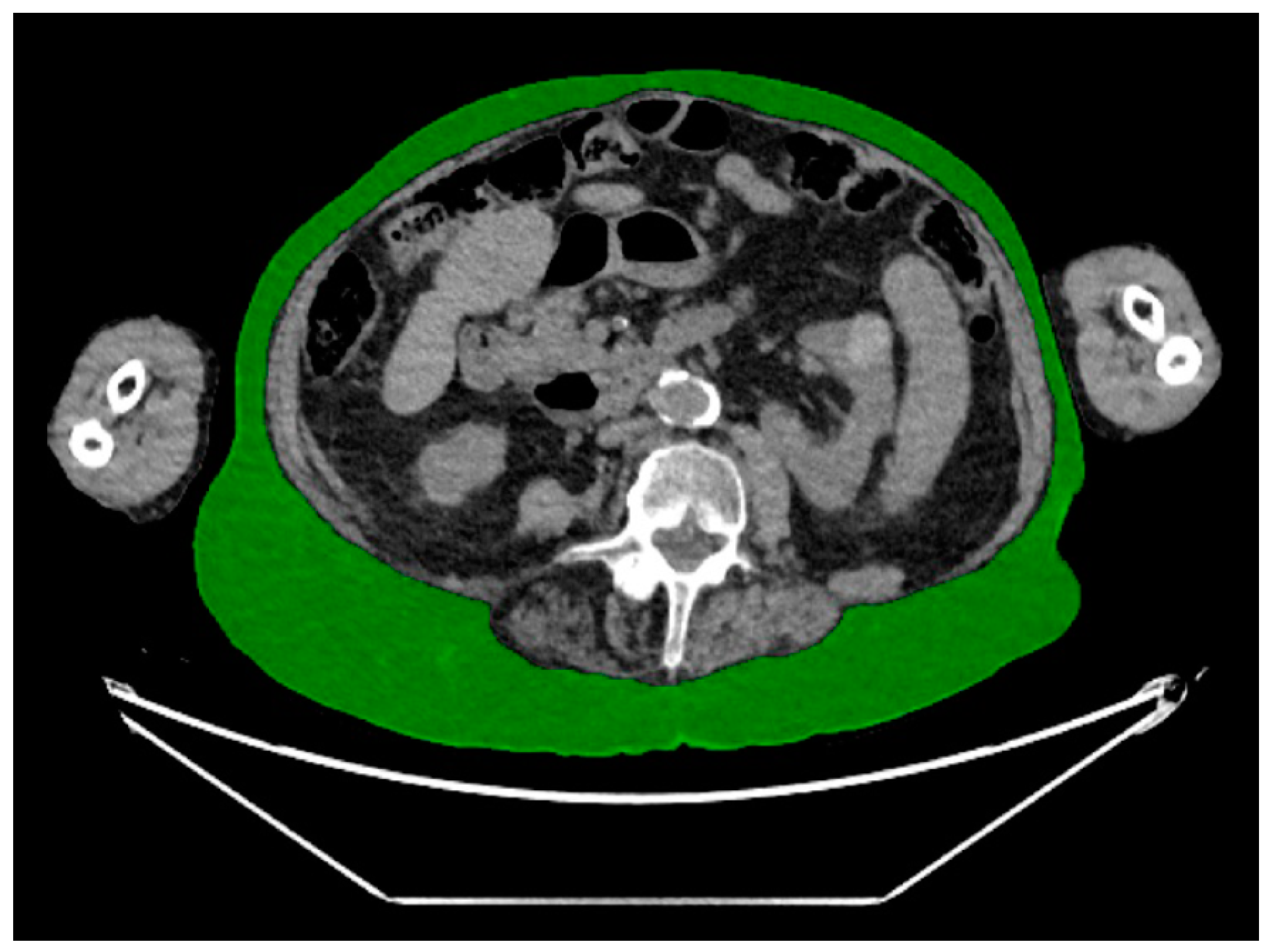 Diagnostics 14 00844 g001