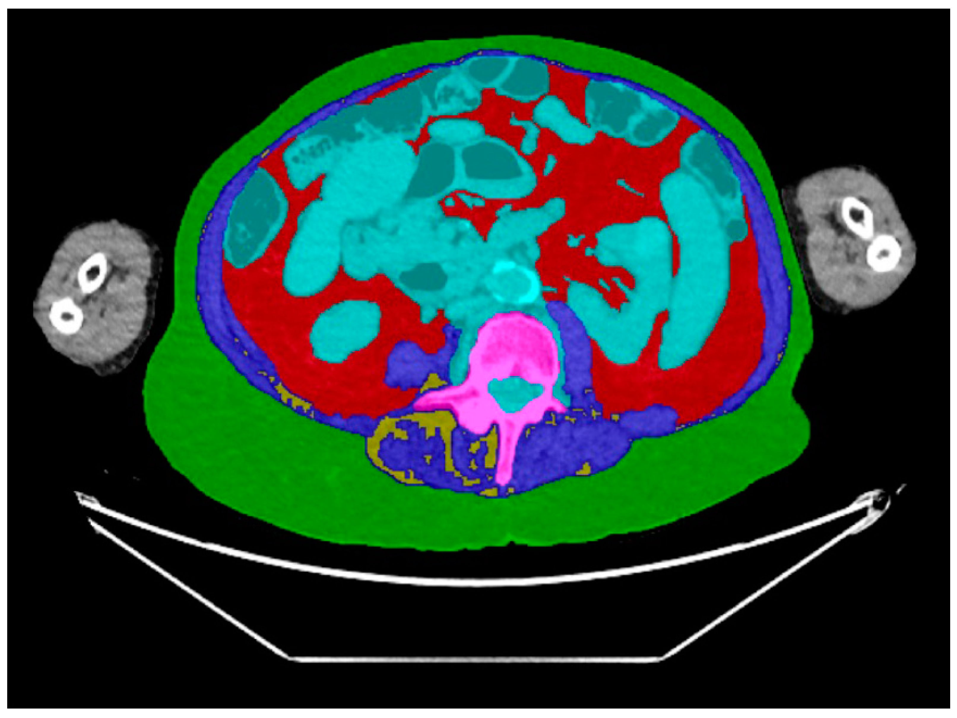Diagnostics 14 00844 g004
