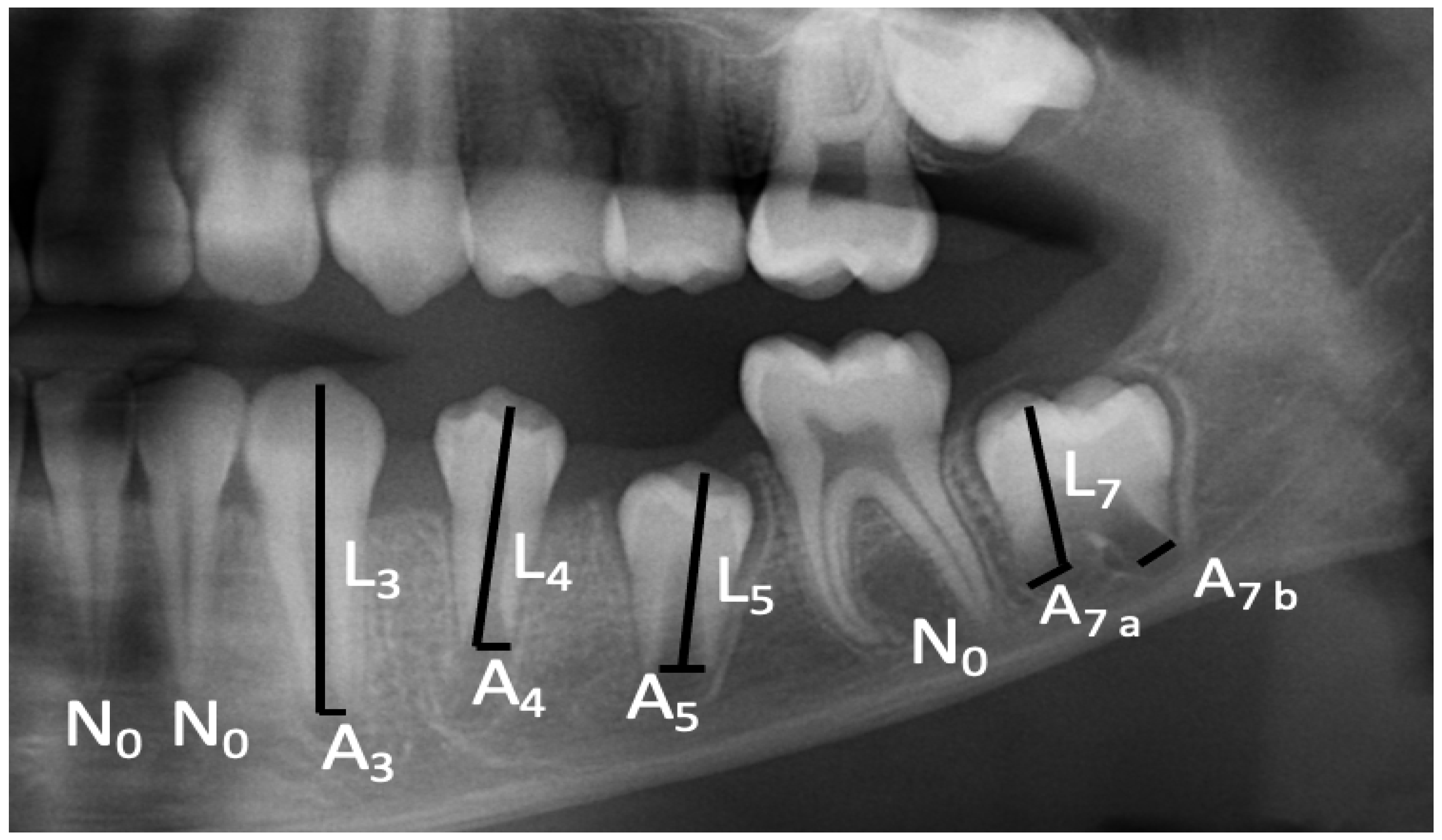 Diagnostics 14 00887 g001