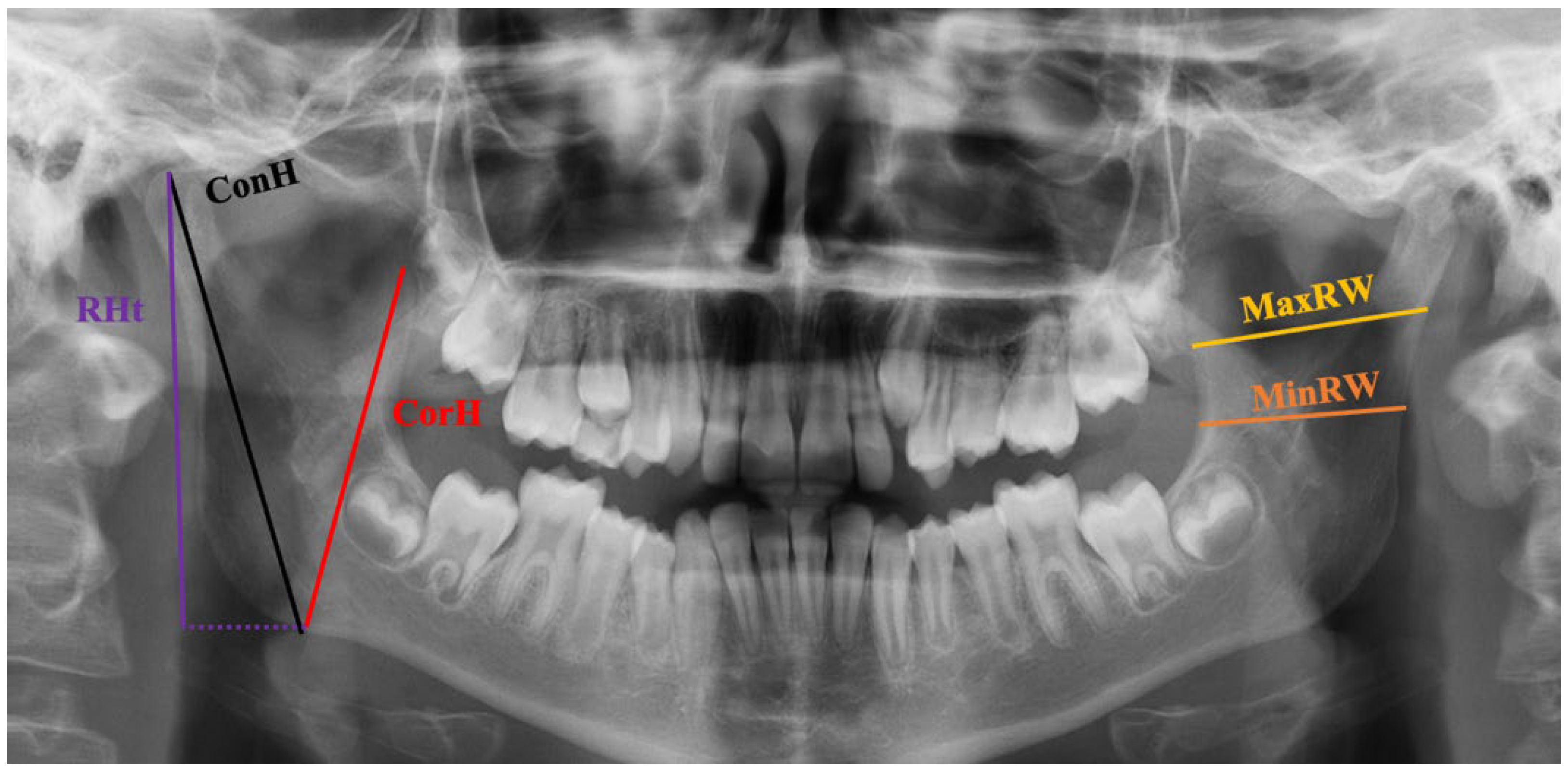 Diagnostics 14 00887 g002
